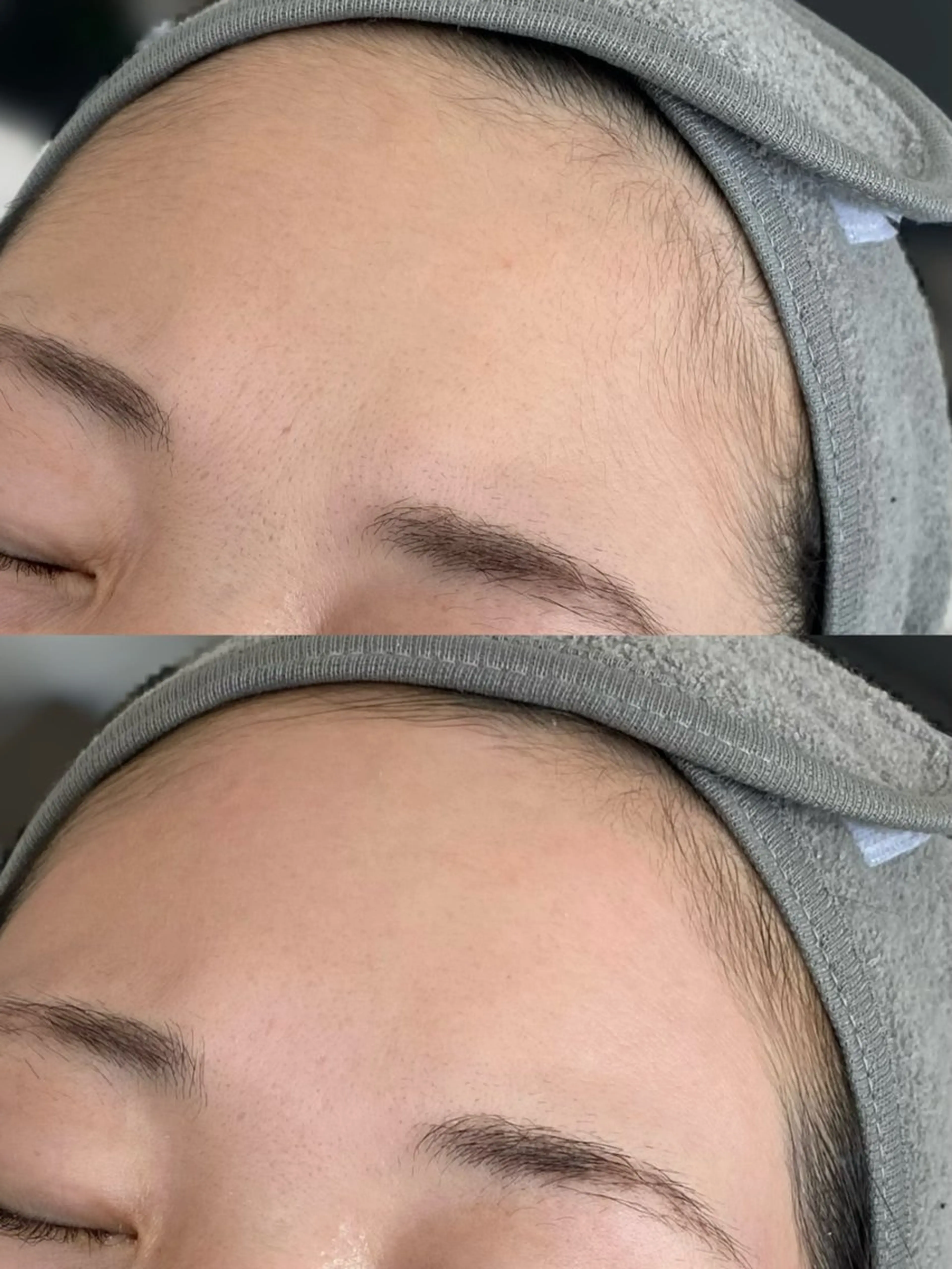 脱毛 schön所属・schön 松井のエステ・リラクイメージ