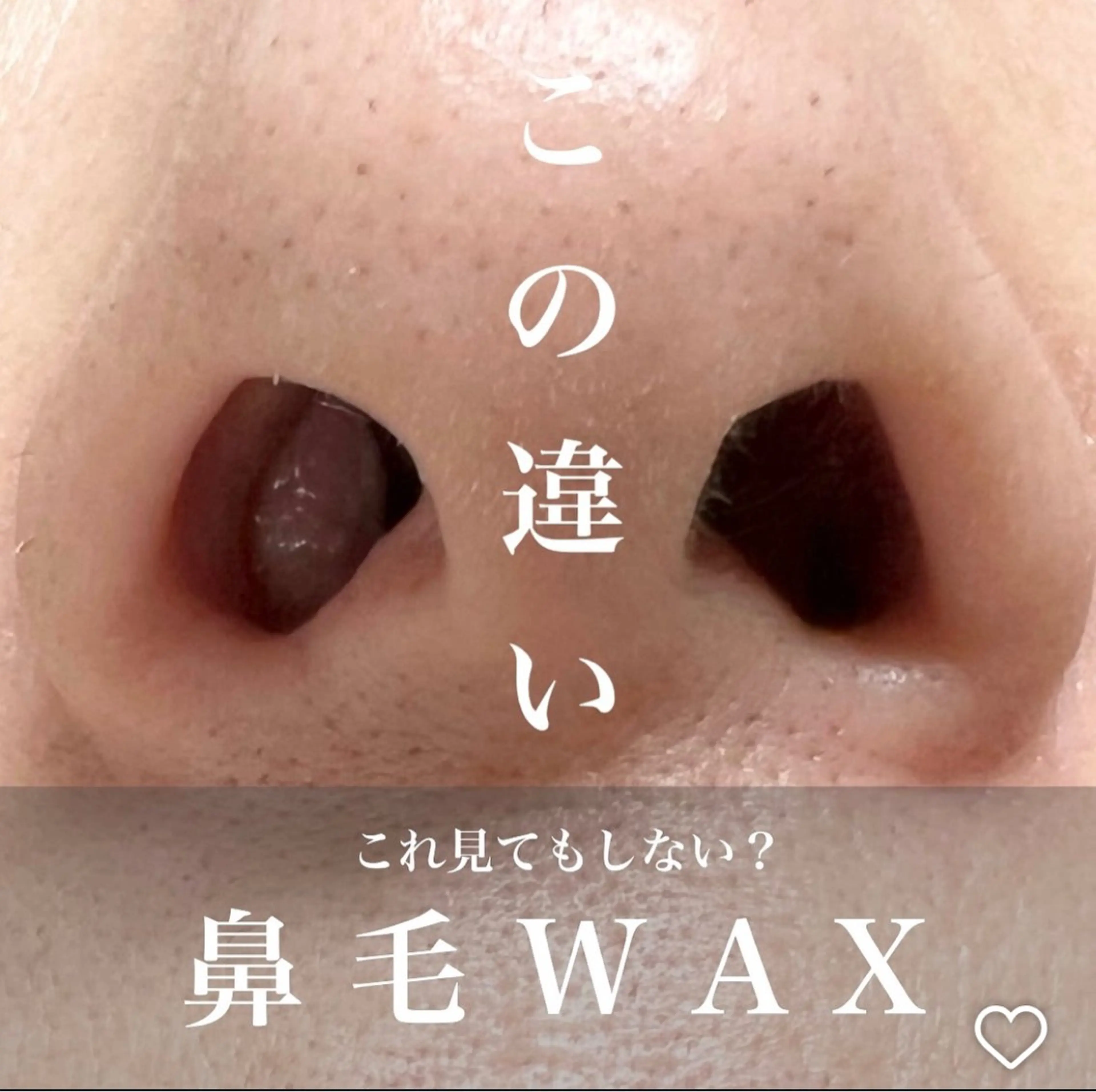 頭皮・薄毛改善サロン ｜眉毛｜痩身のエステ・リラクイメージ