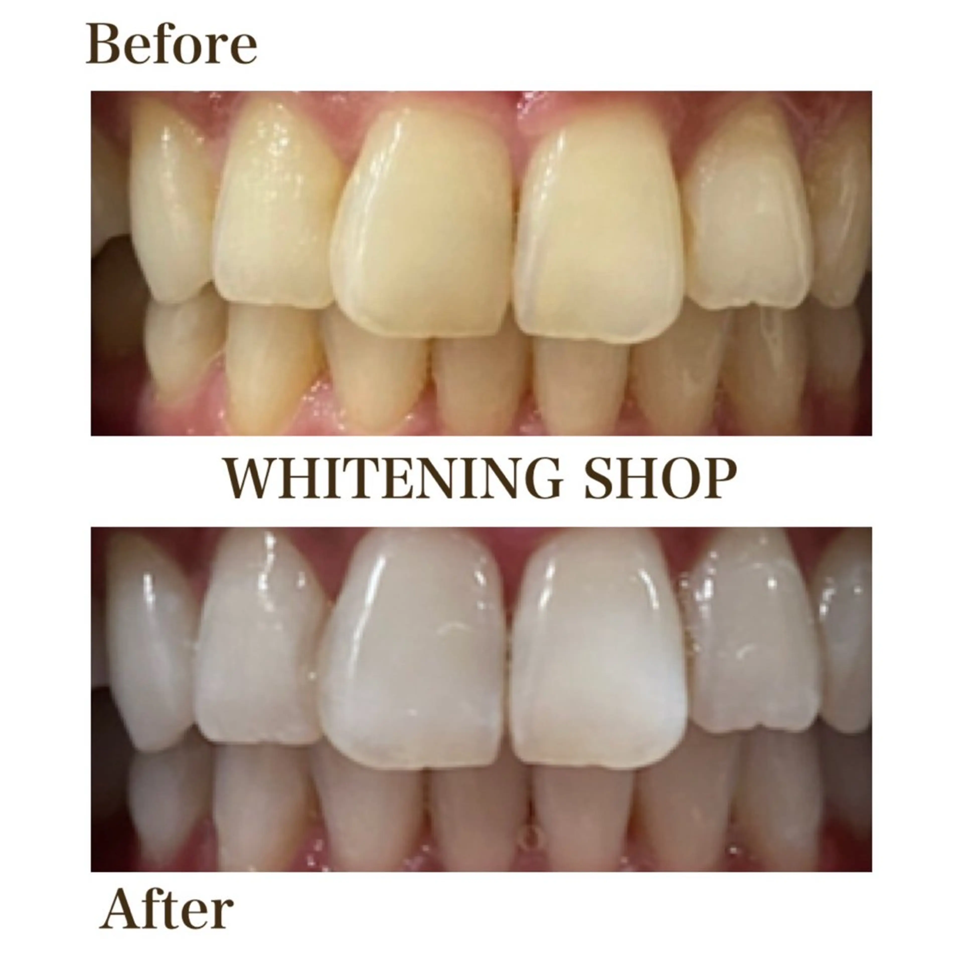 メンズ エステ リラク ホワイトニング ショップ川越店のエステ・リラクイメージ