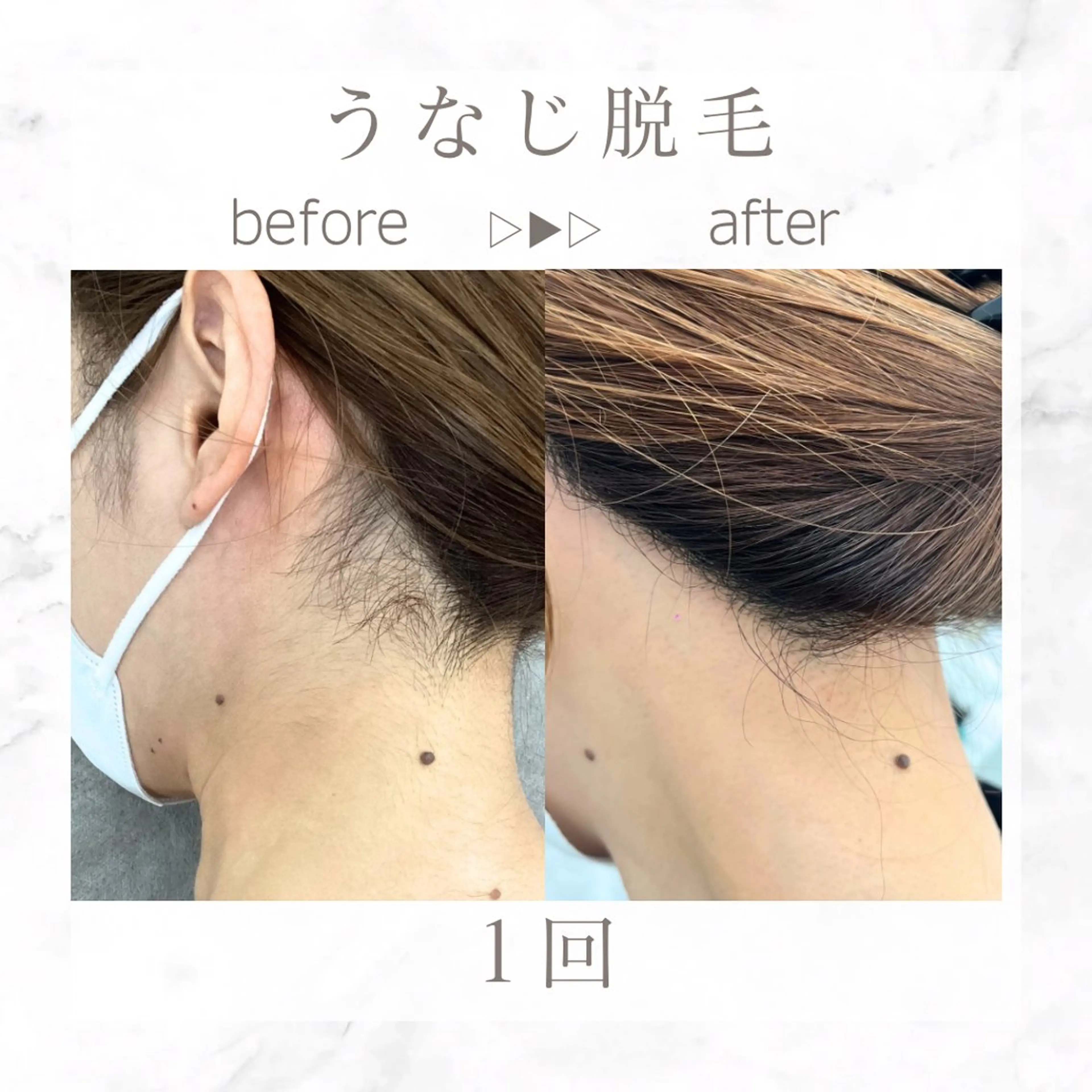 脱毛 エステサロンNarcis〜ナルシス〜所属・脱毛＆痩身エステ Narcisのエステ・リラクイメージ