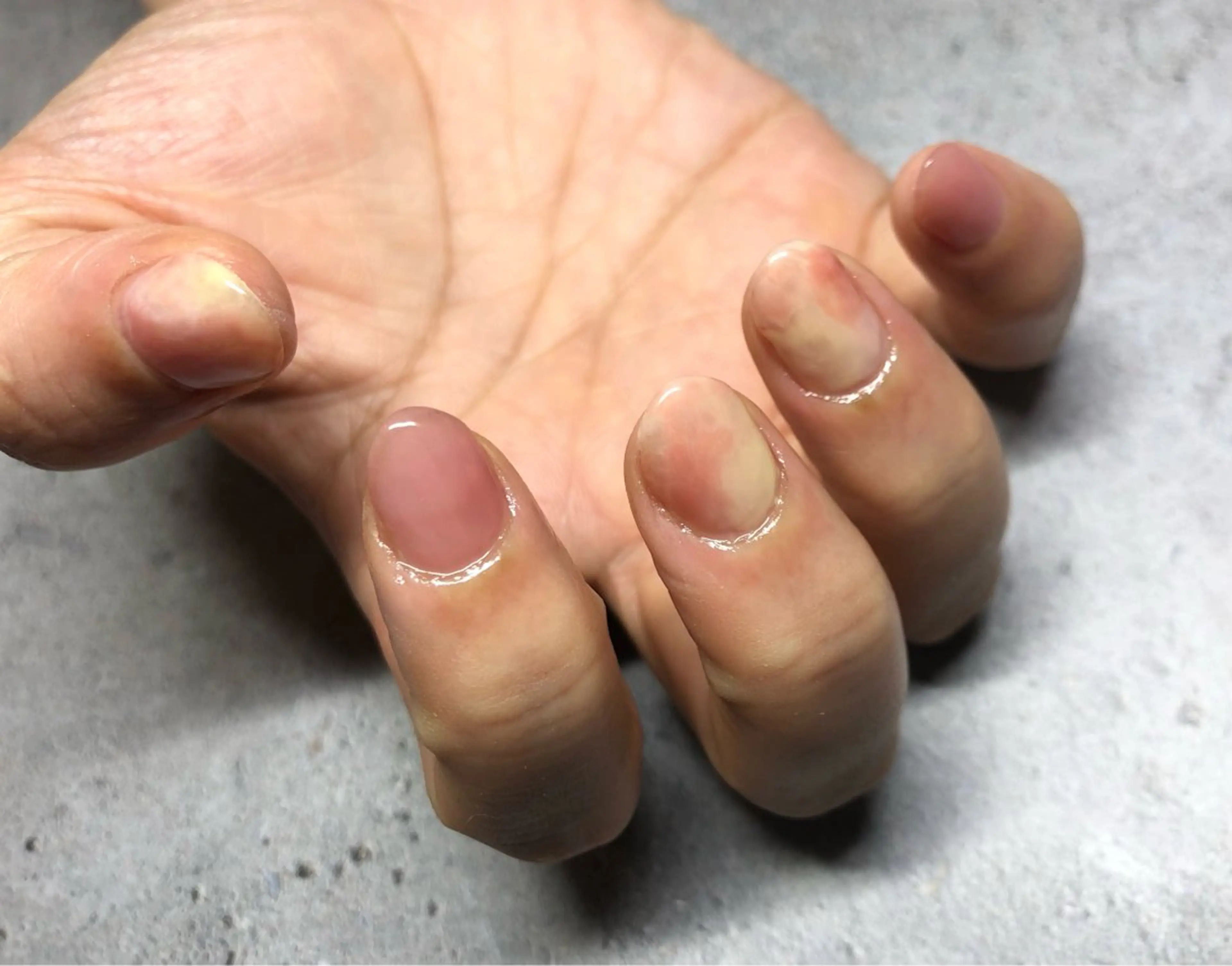 ネイル kimura kumikoのネイルデザイン