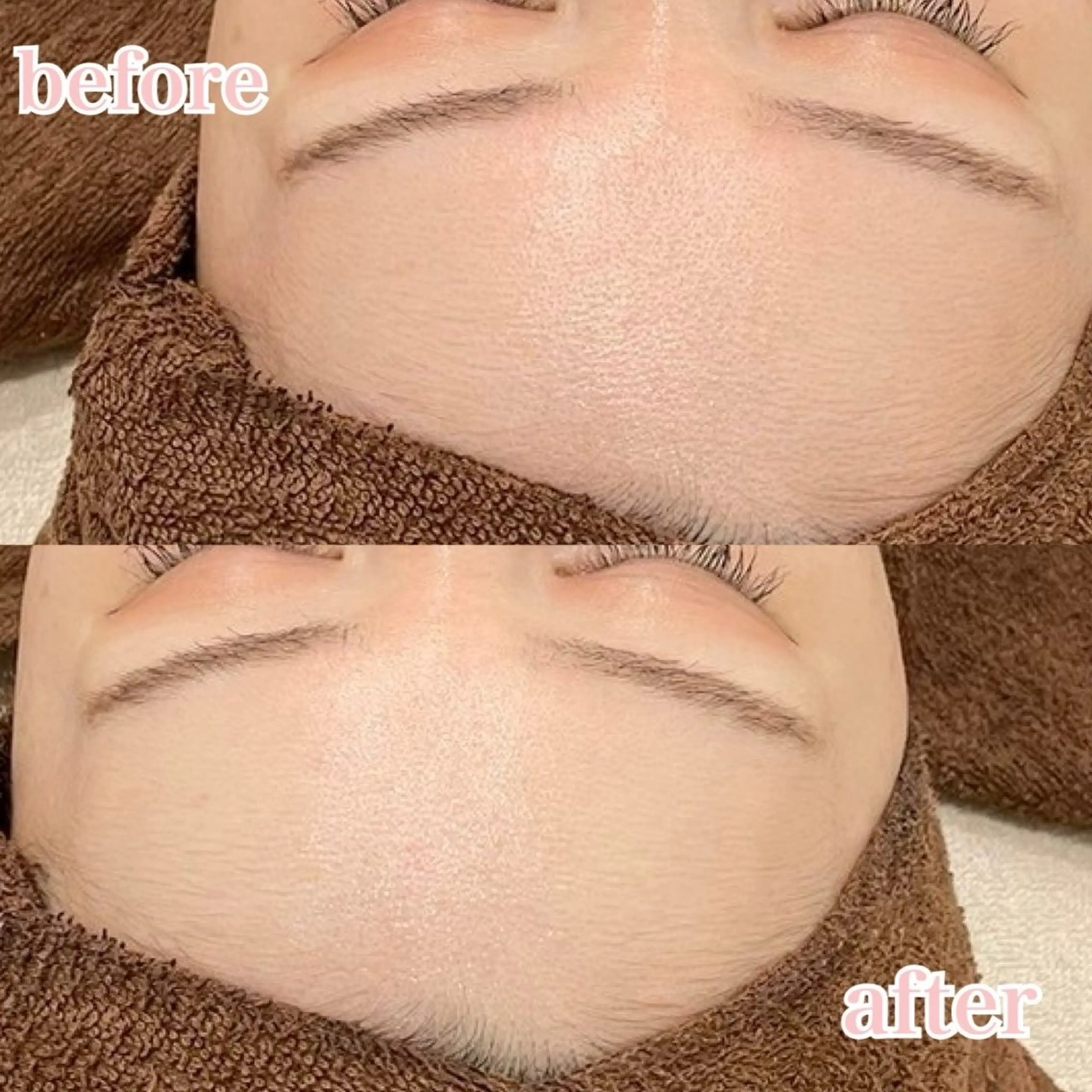 肌管理専門店Whitelabo堺東店所属・おだ あみのエステ・リラクイメージ