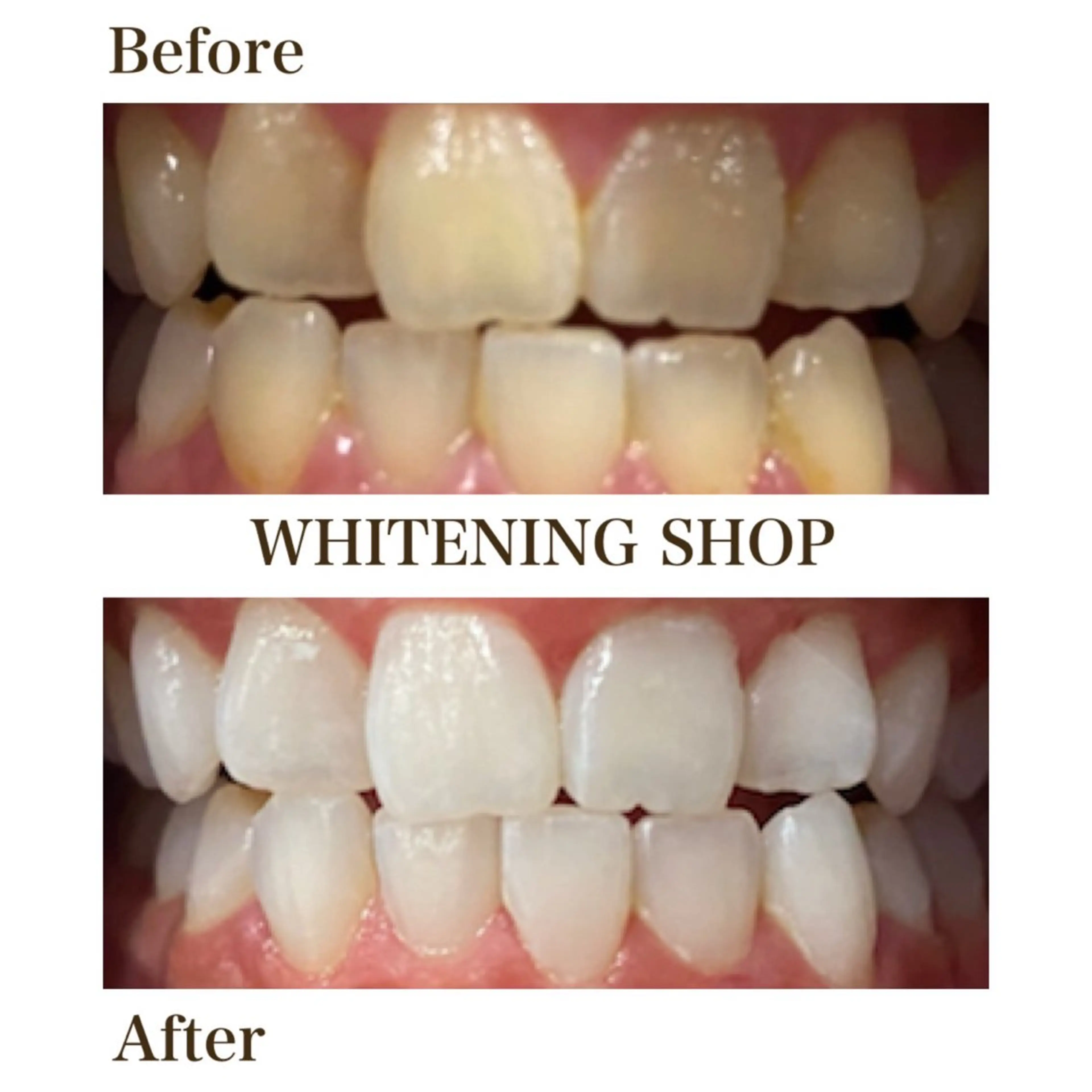 メンズ エステ リラク ホワイトニング ショップ川越店のエステ・リラクイメージ