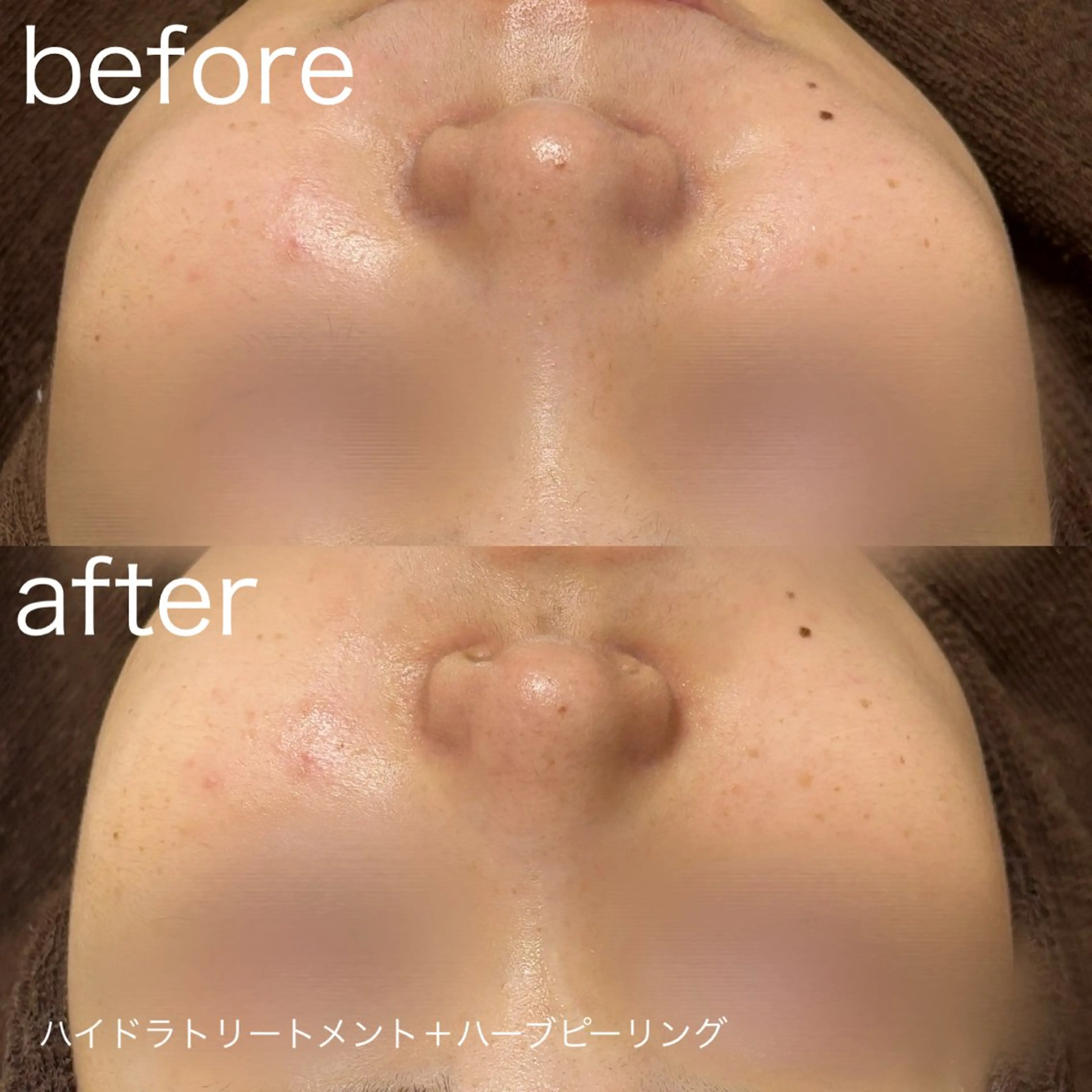 その他 lulularico Yuのエステ・リラクイメージ