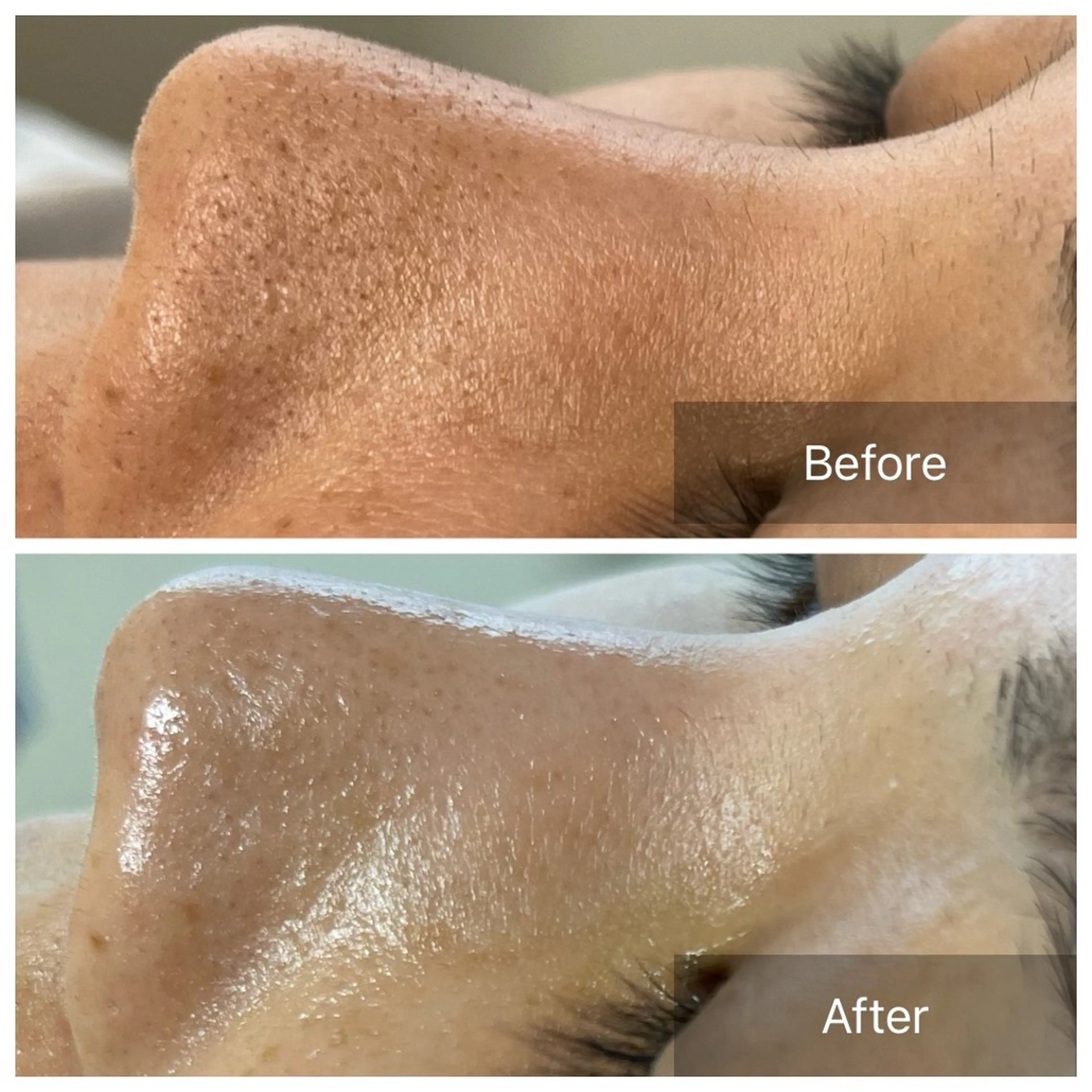 毛穴が見えなくなるサロン  Horo所属・岡 えり子のエステ・リラクイメージ