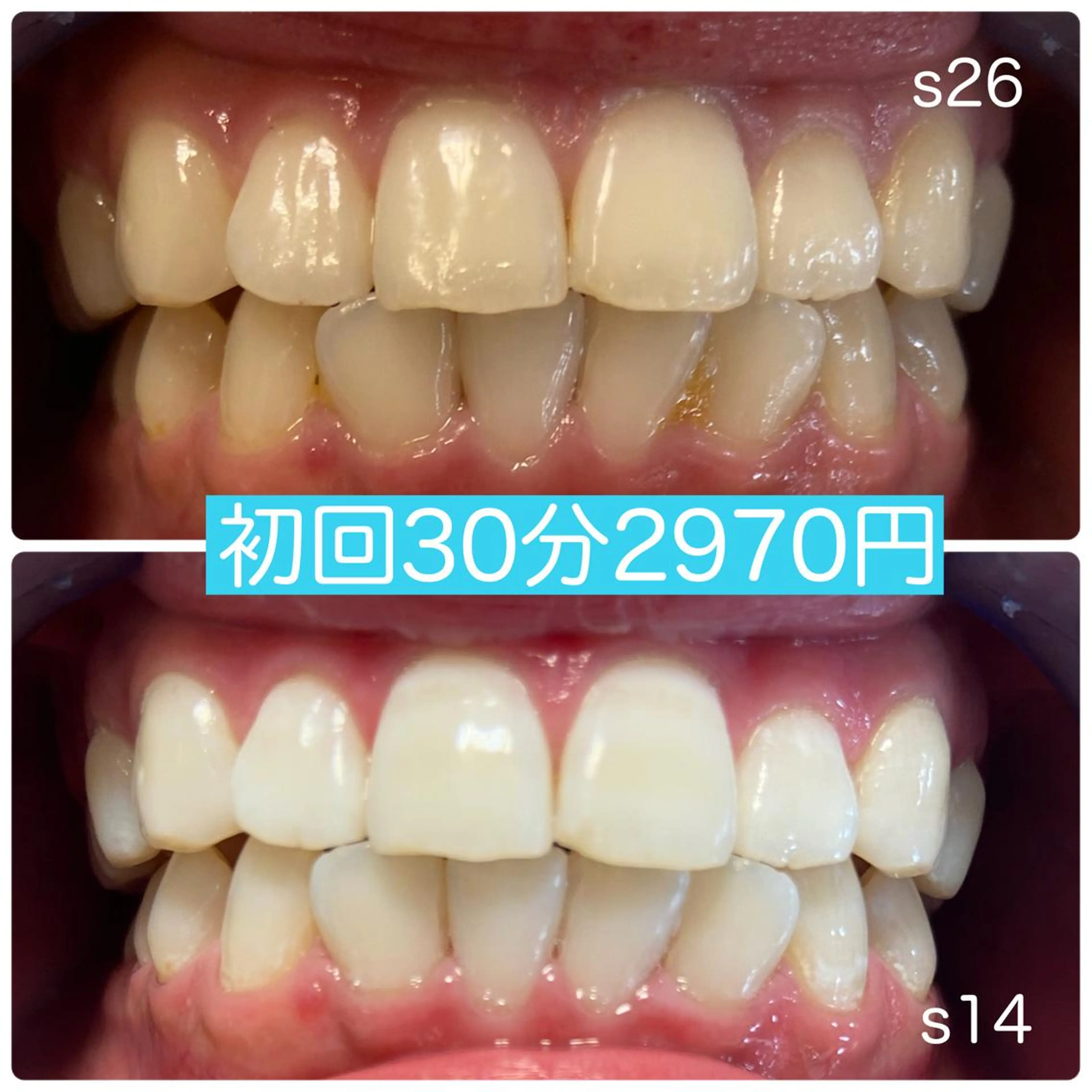 その他 PLATINUM Beauty 横浜店所属・ホワイトニングルーム 横浜店のその他イメージ