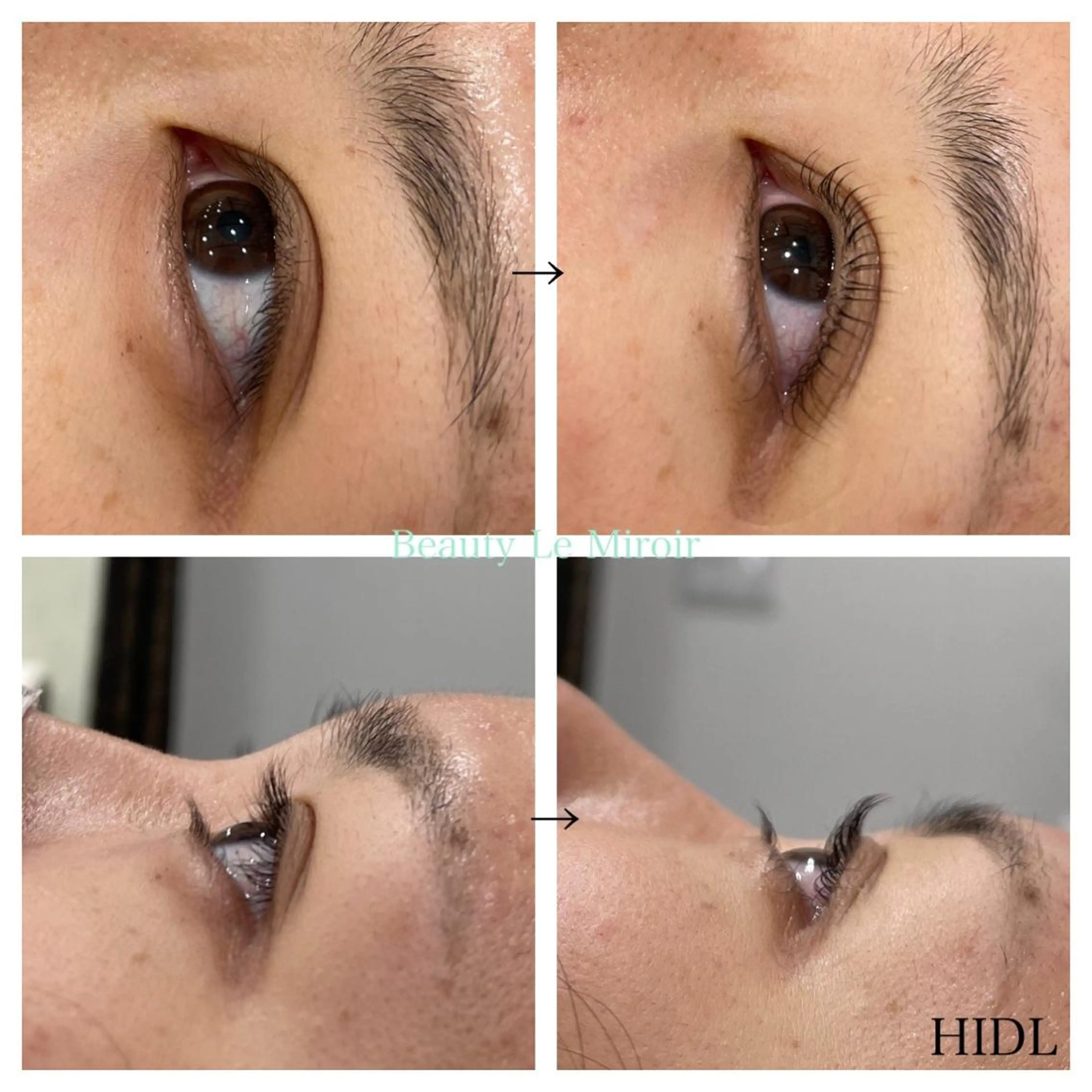 マツエク・マツパ ビューティー ミロワールのエステ・リラクイメージ