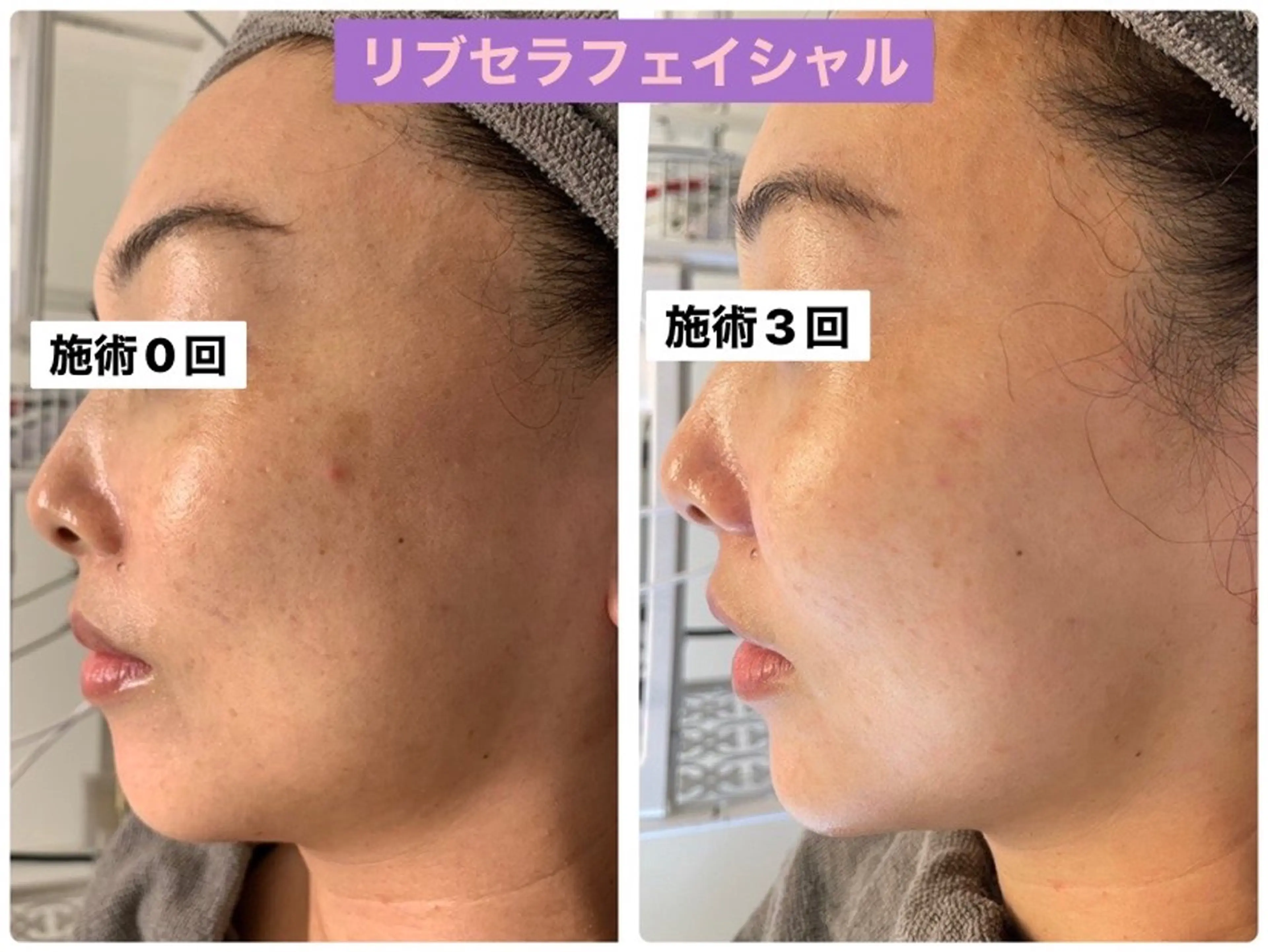 エステ Private Salon Prunelle所属・プライベートサロン プリュネルのエステ・リラクイメージ