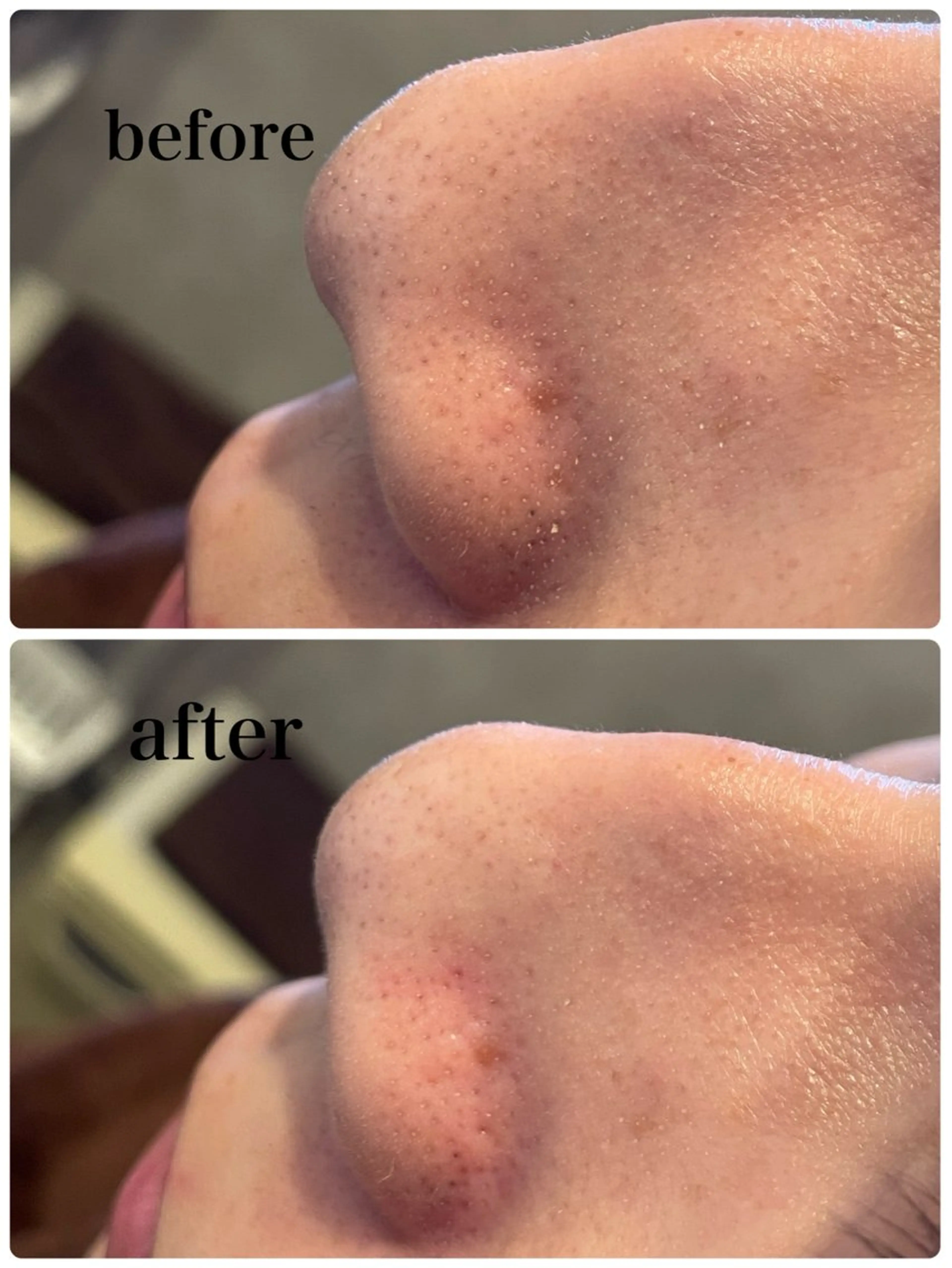 Dears /道後/フェイシャルのエステ・リラクイメージ