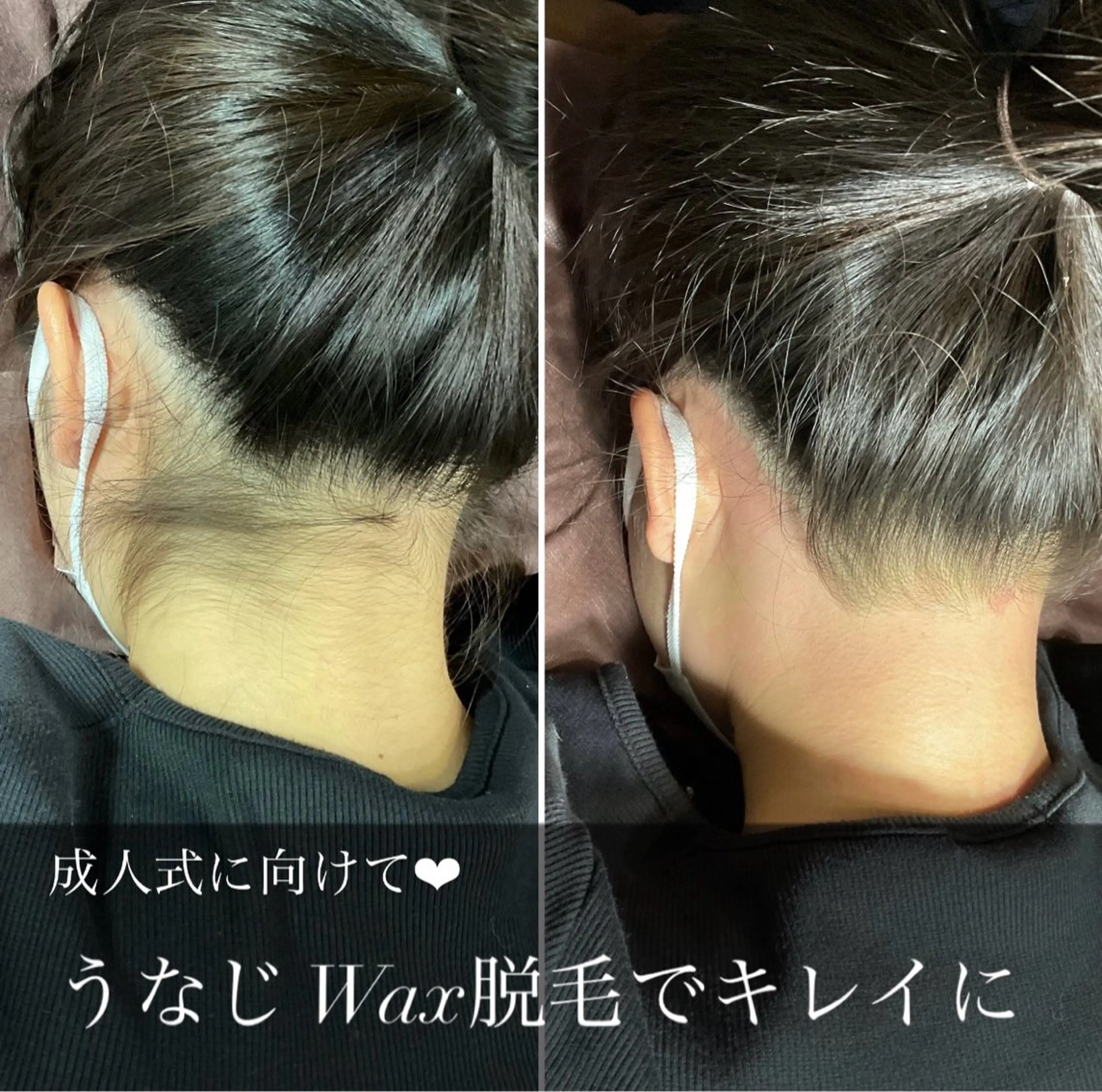 エピナス町田店 ブラジリアンワックスのエステ・リラクイメージ