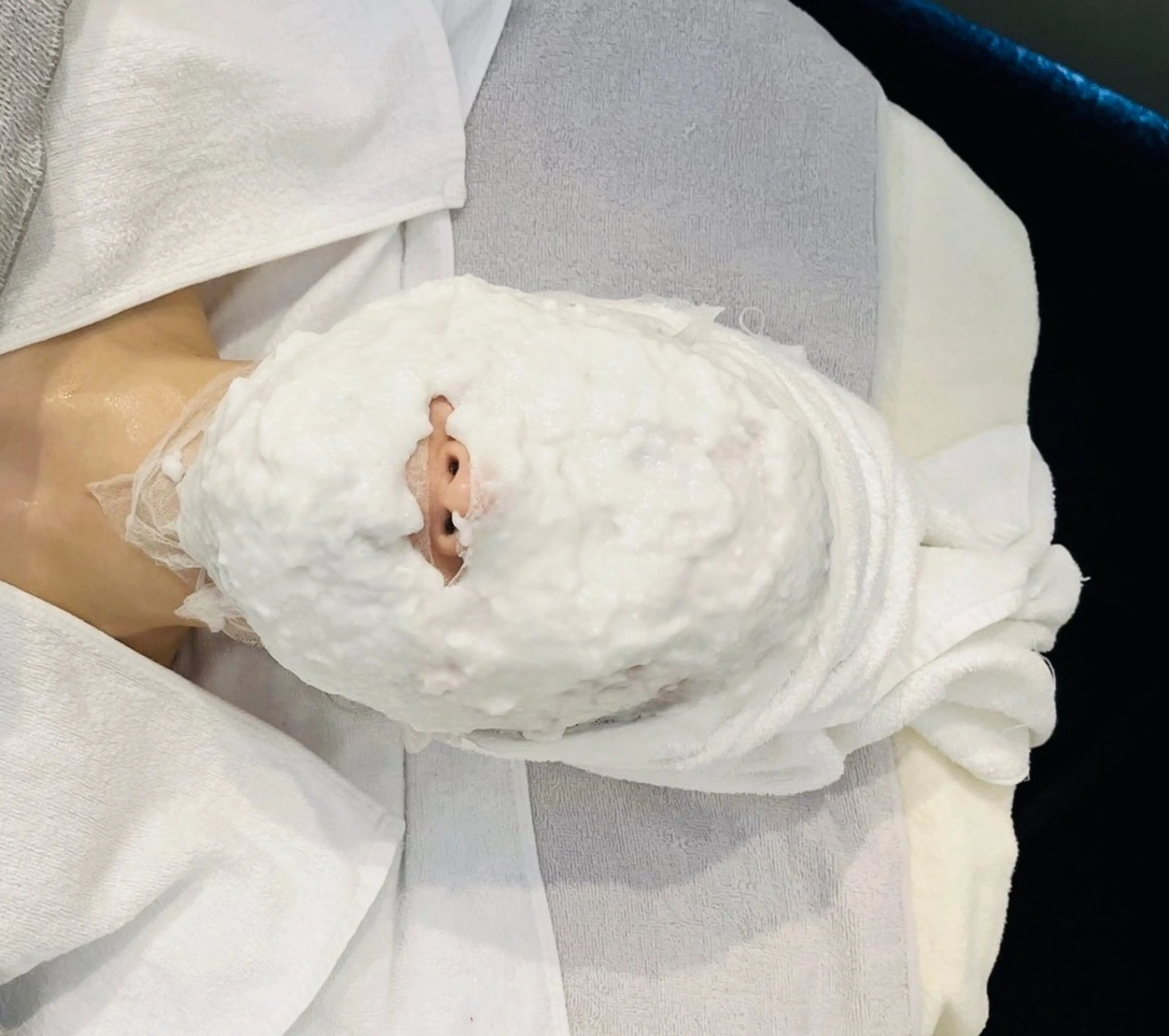 エステ 毛穴/ピーリング ララピール/POLAのエステ・リラクイメージ