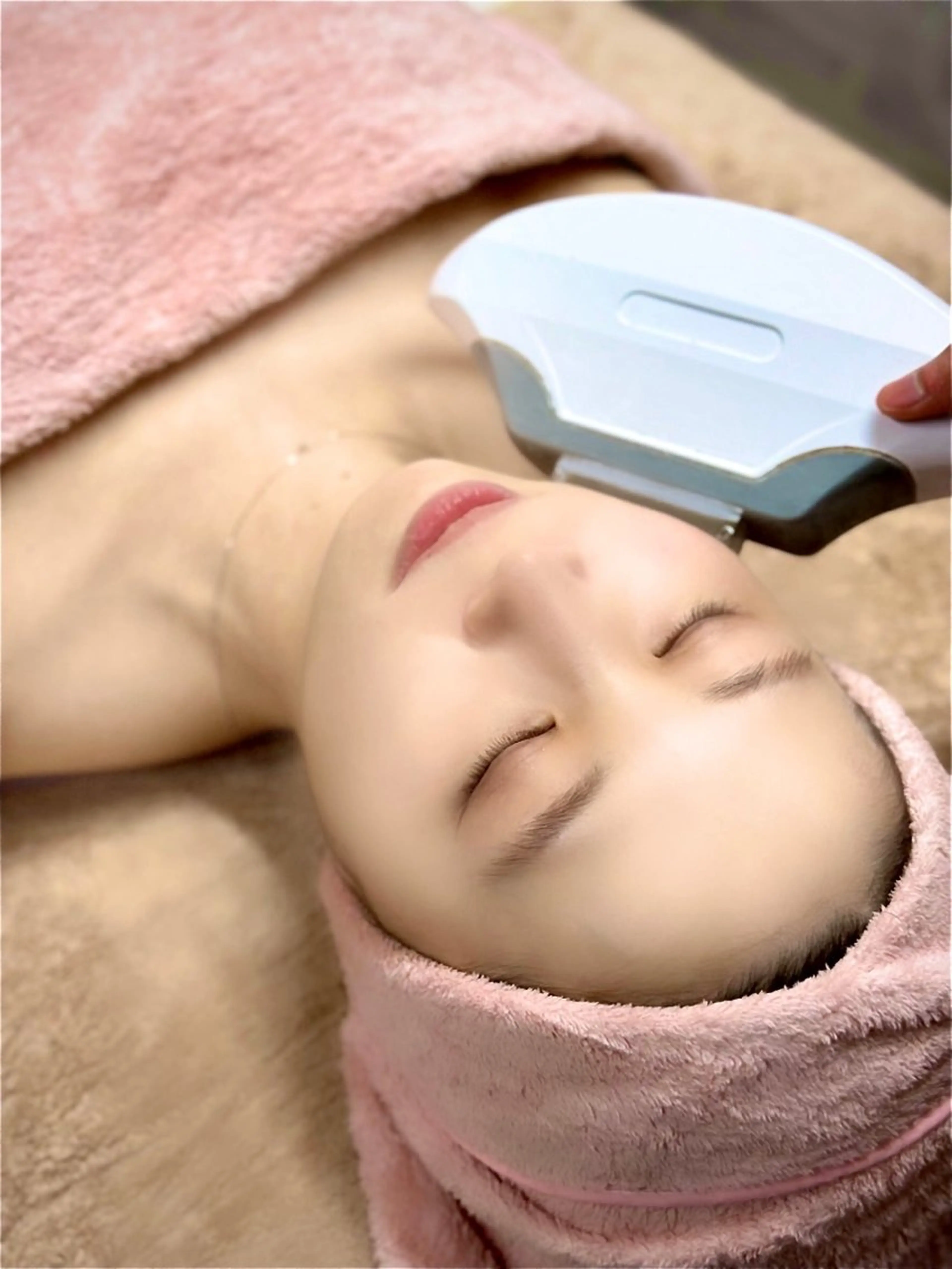 美肌全身脱毛【顔・VIO込み】ＩＰＬ脱毛　1回の写真