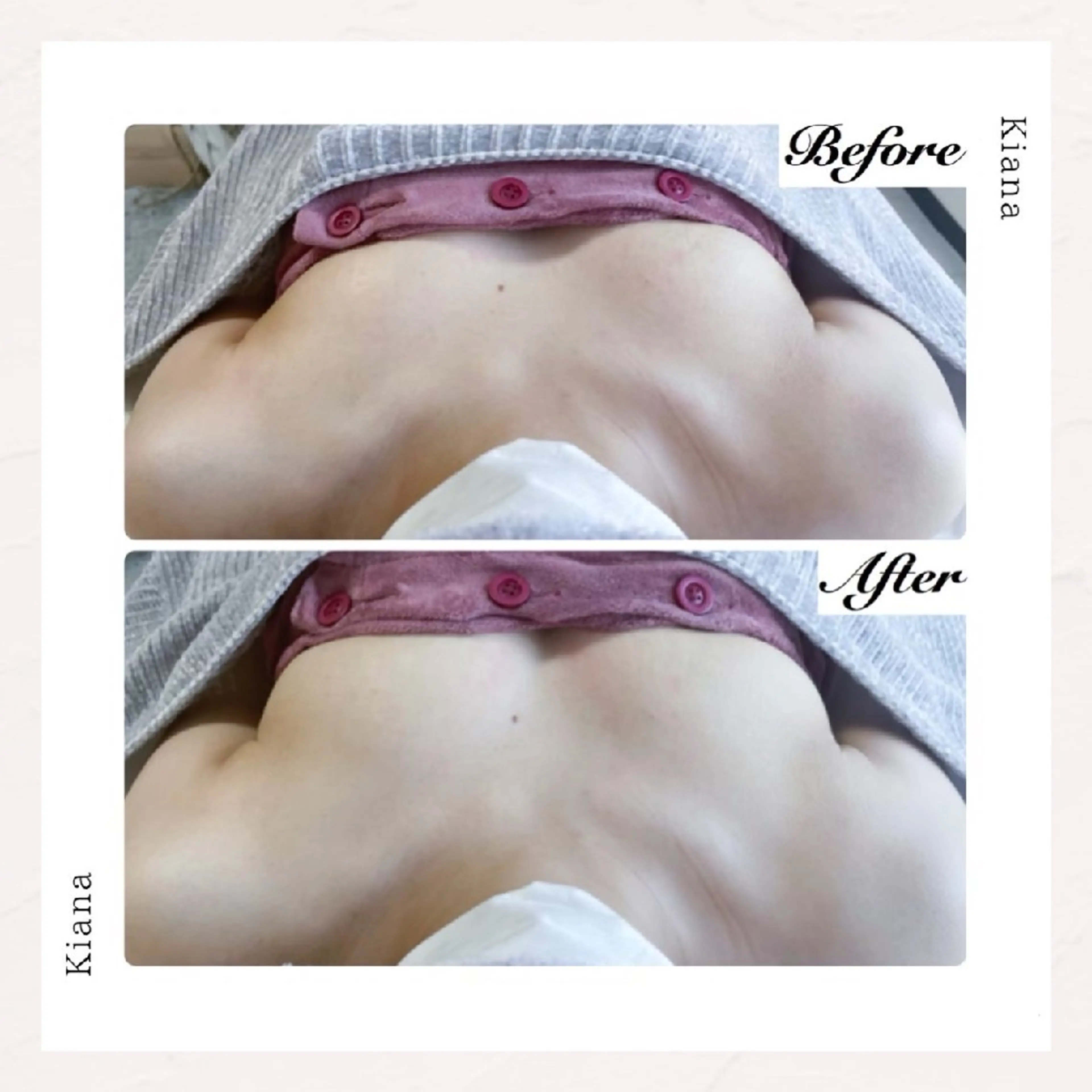 【バスト専門店 】 Kiana のエステ・リラクイメージ