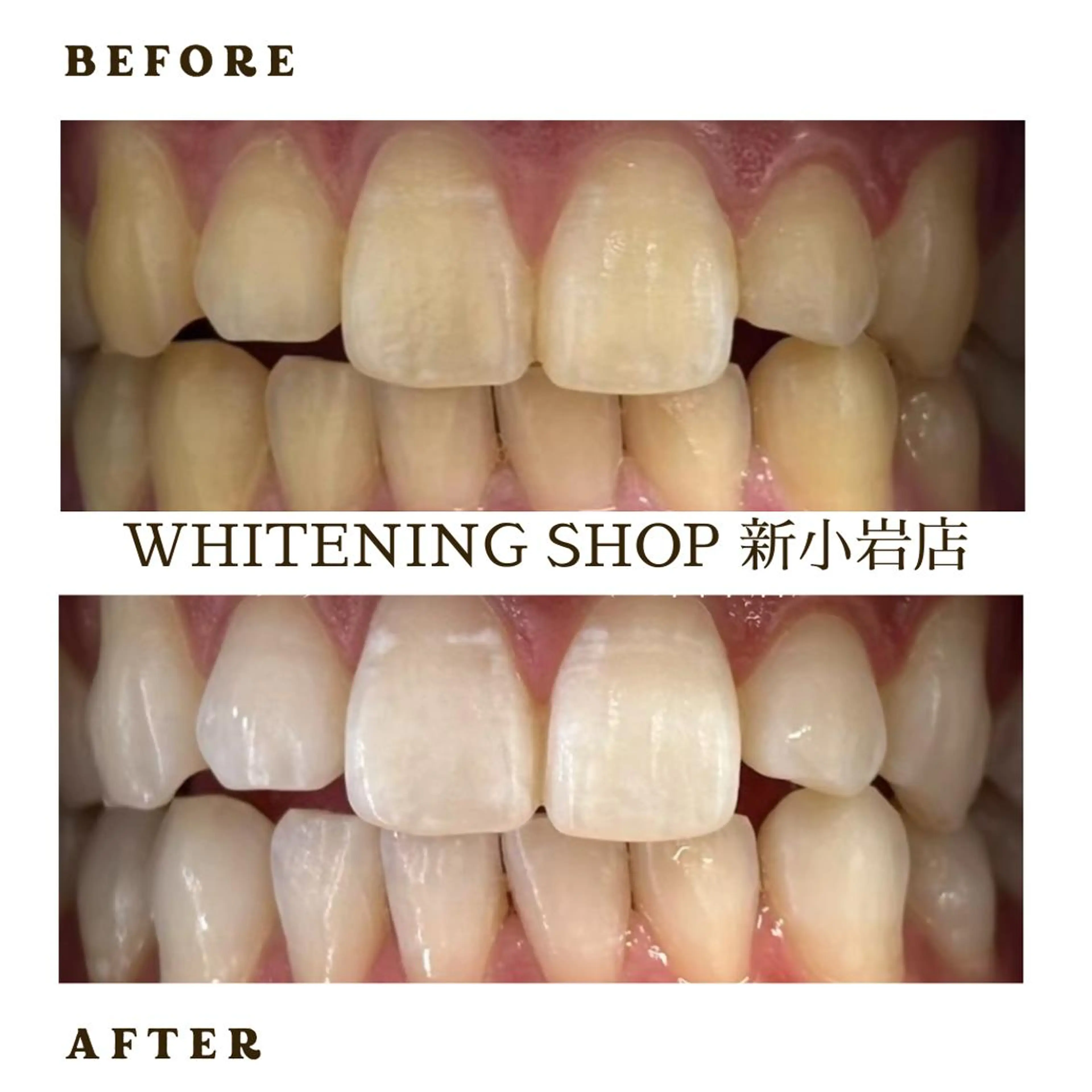 メンズ その他 ホワイトニング ショップ新小岩店のその他イメージ