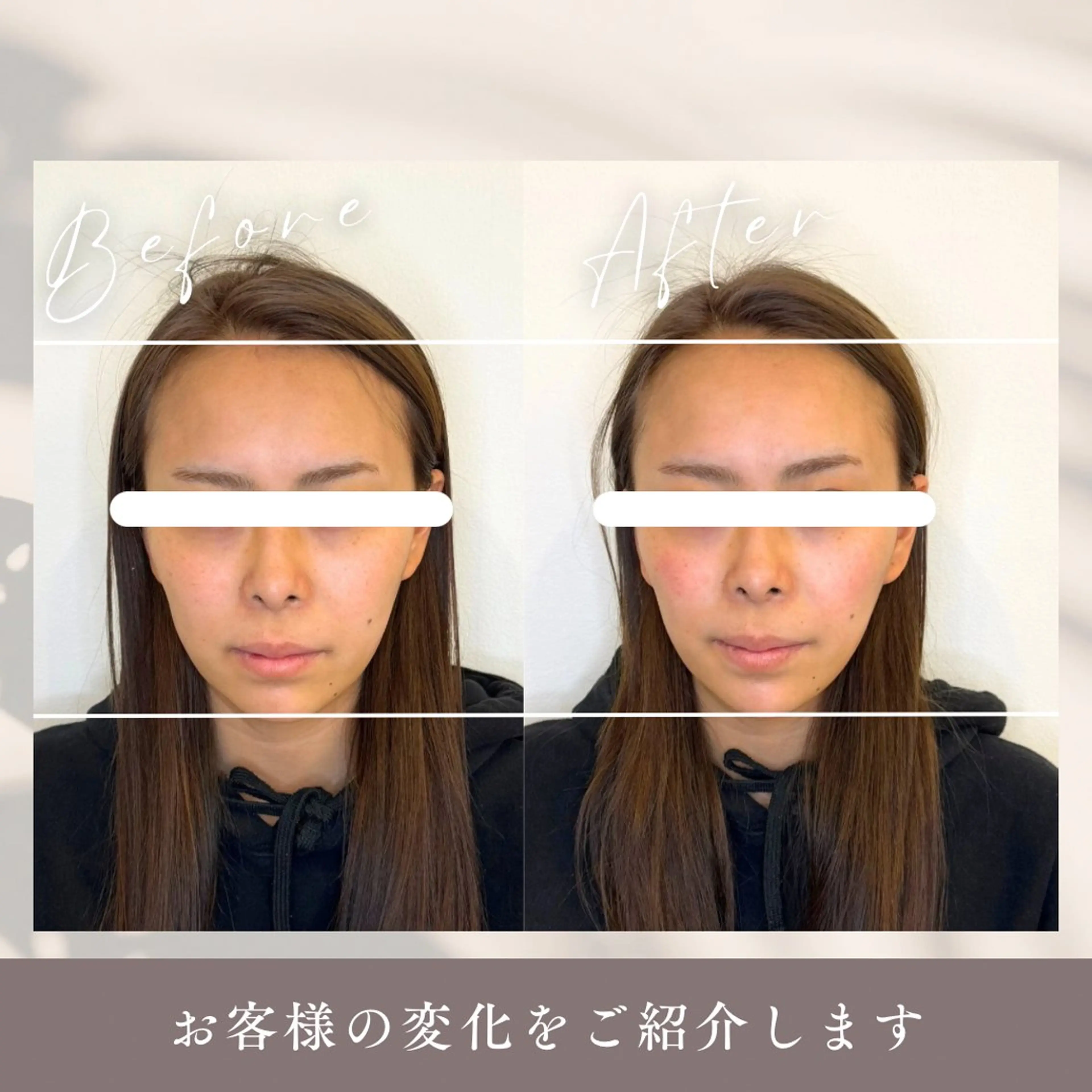 小顔矯正&美容整体 整え屋REDオーナーのエステ・リラクイメージ