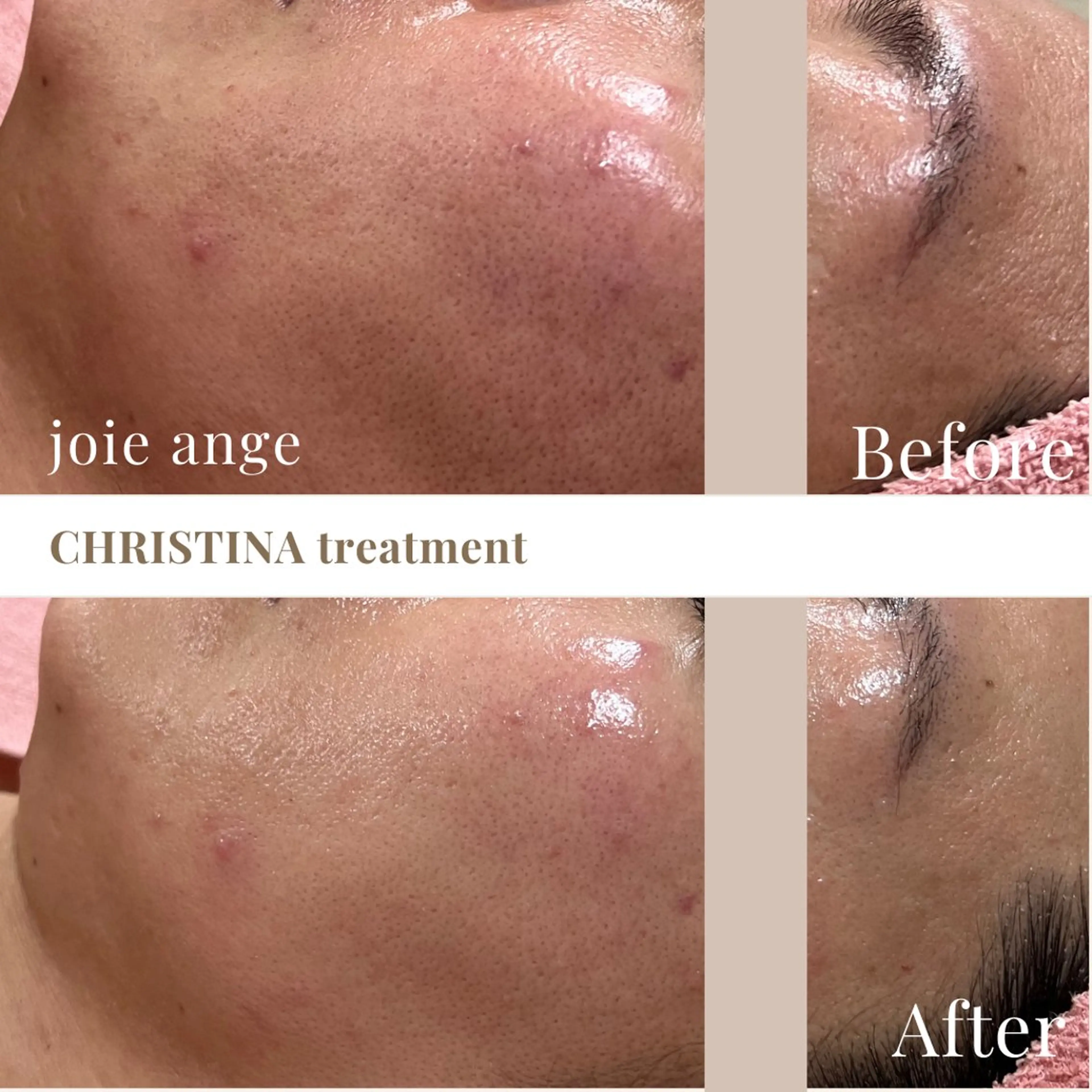 エステ フェイシャル/脱毛 ジョアアンジェ さきのエステ・リラクイメージ