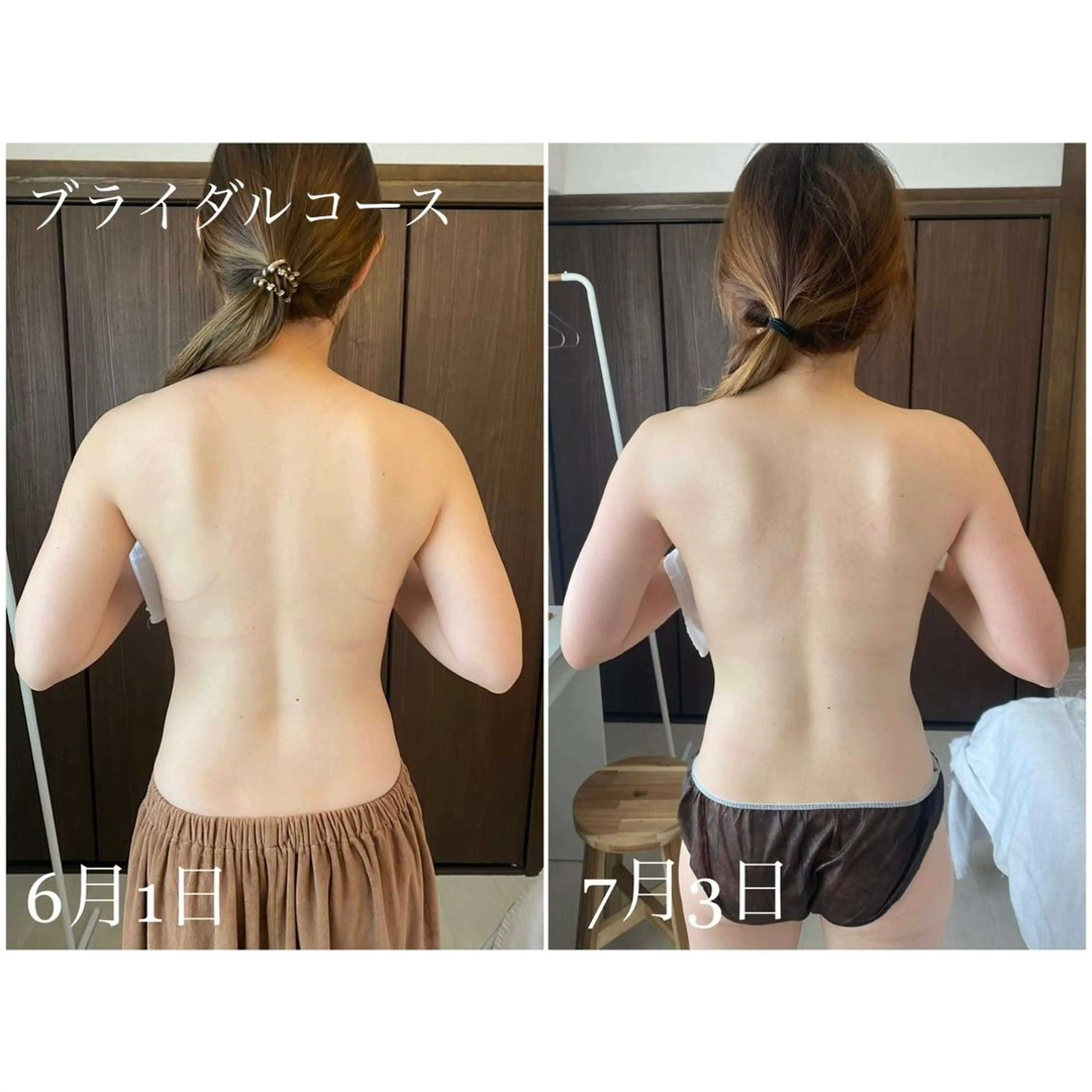 I'm -ｲﾑ-所属・肌質改善／ブライダル I'm.-イム-のエステ・リラクイメージ