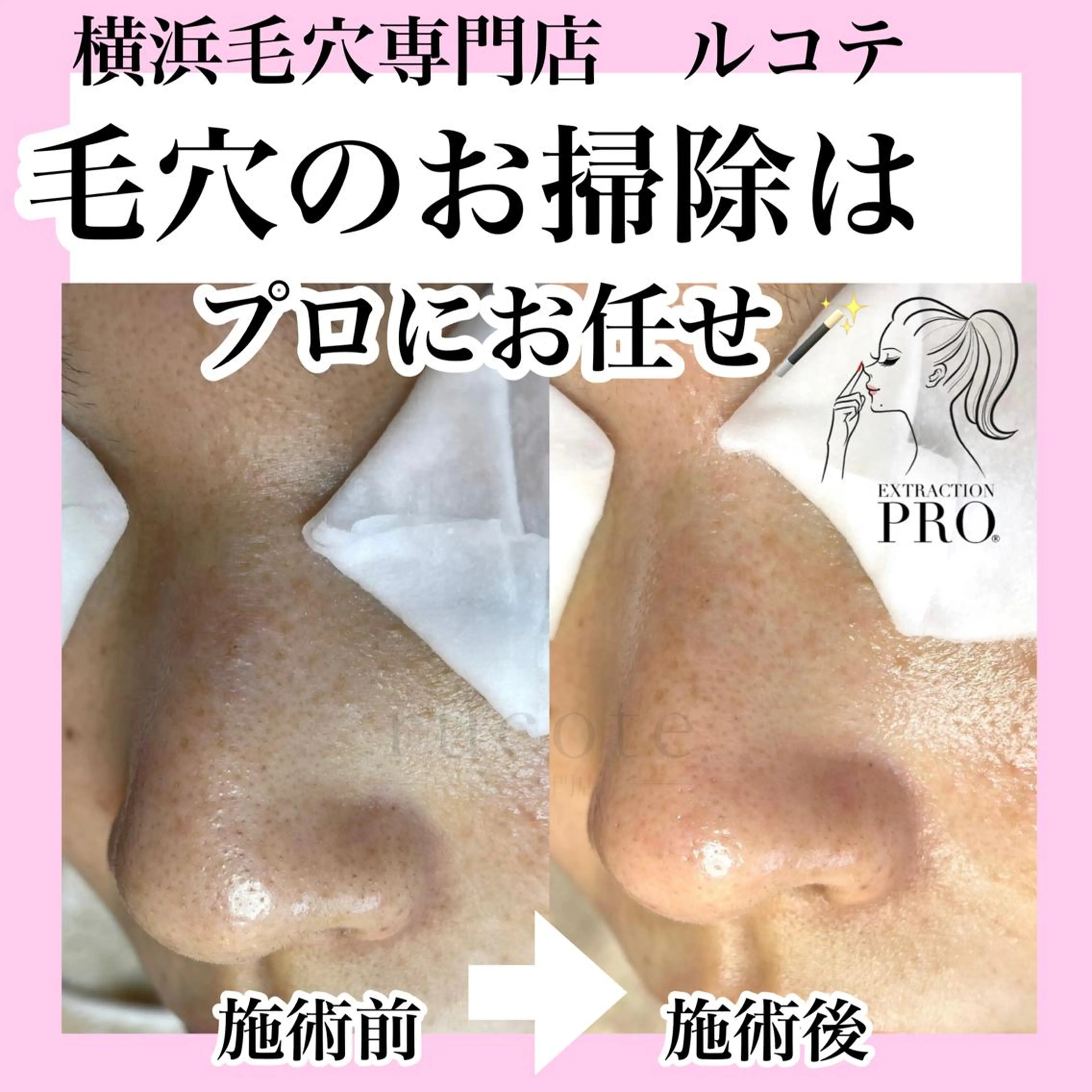 アイラッシュサロン ルコテの眉毛・アイブロウイメージ