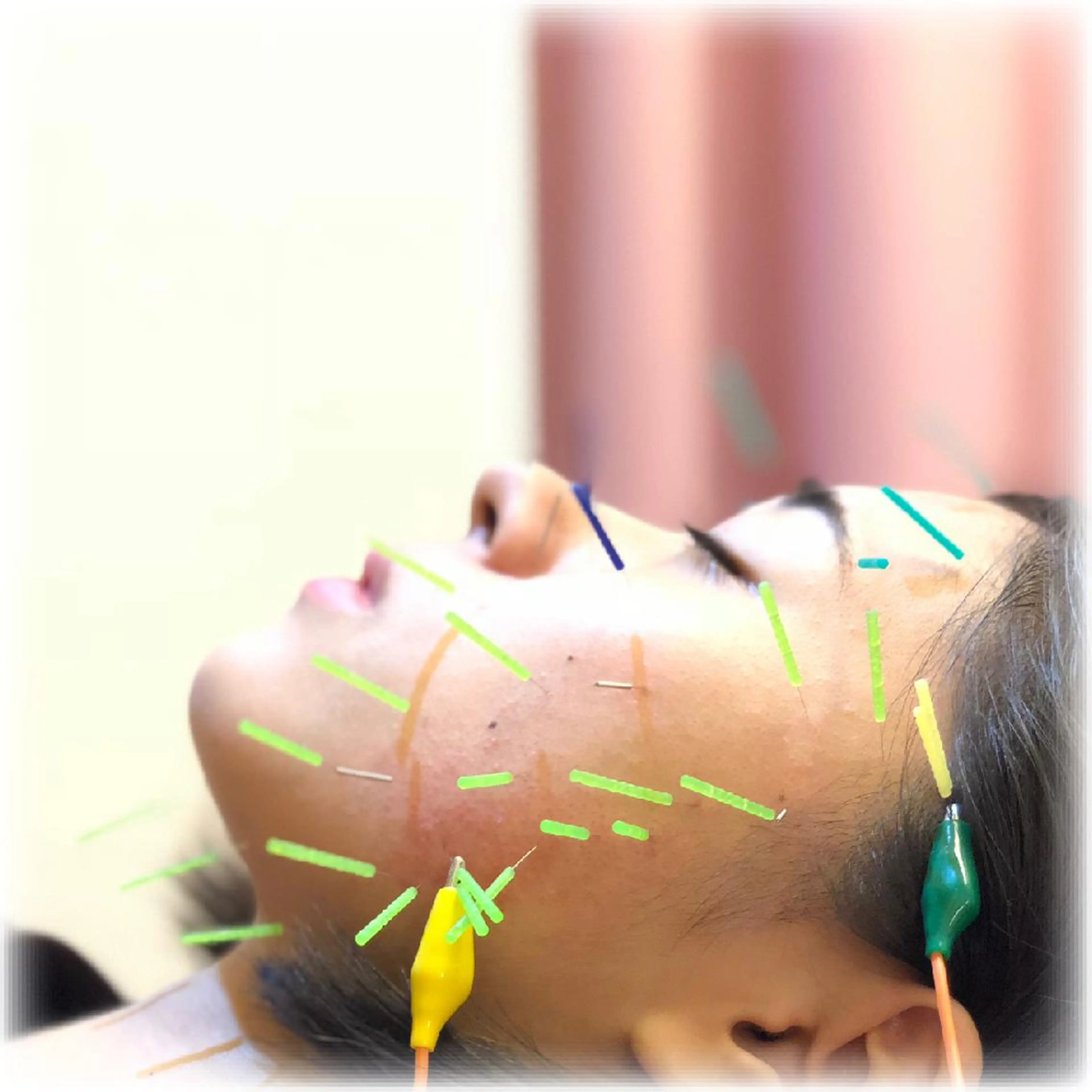 💆‍♀️美鍼/整体 ハリジョ 浜田山✨のエステ・リラクイメージ