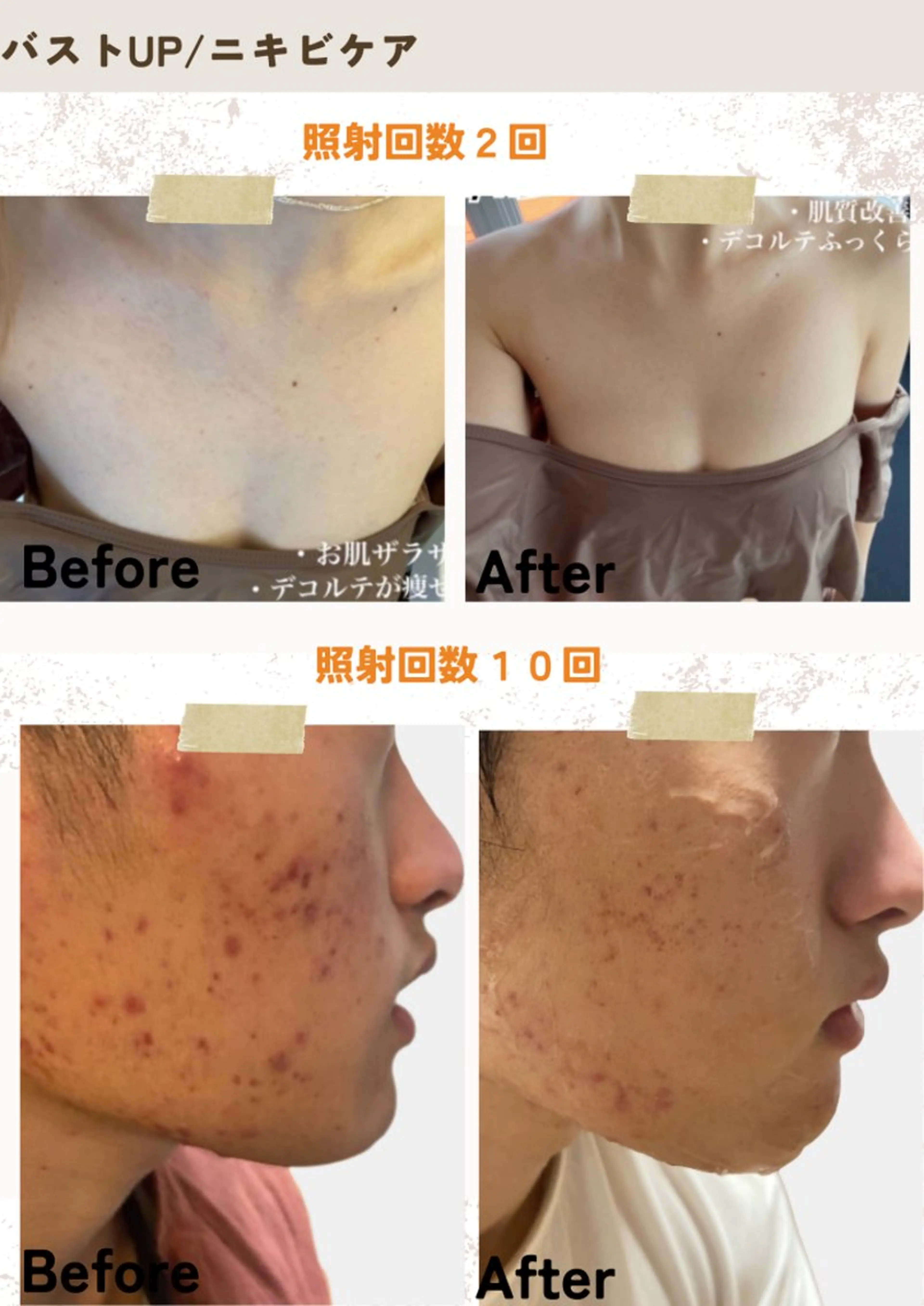 美ボディメイクサロン　only one body所属・所沢 痩身エステサロンのエステ・リラクイメージ