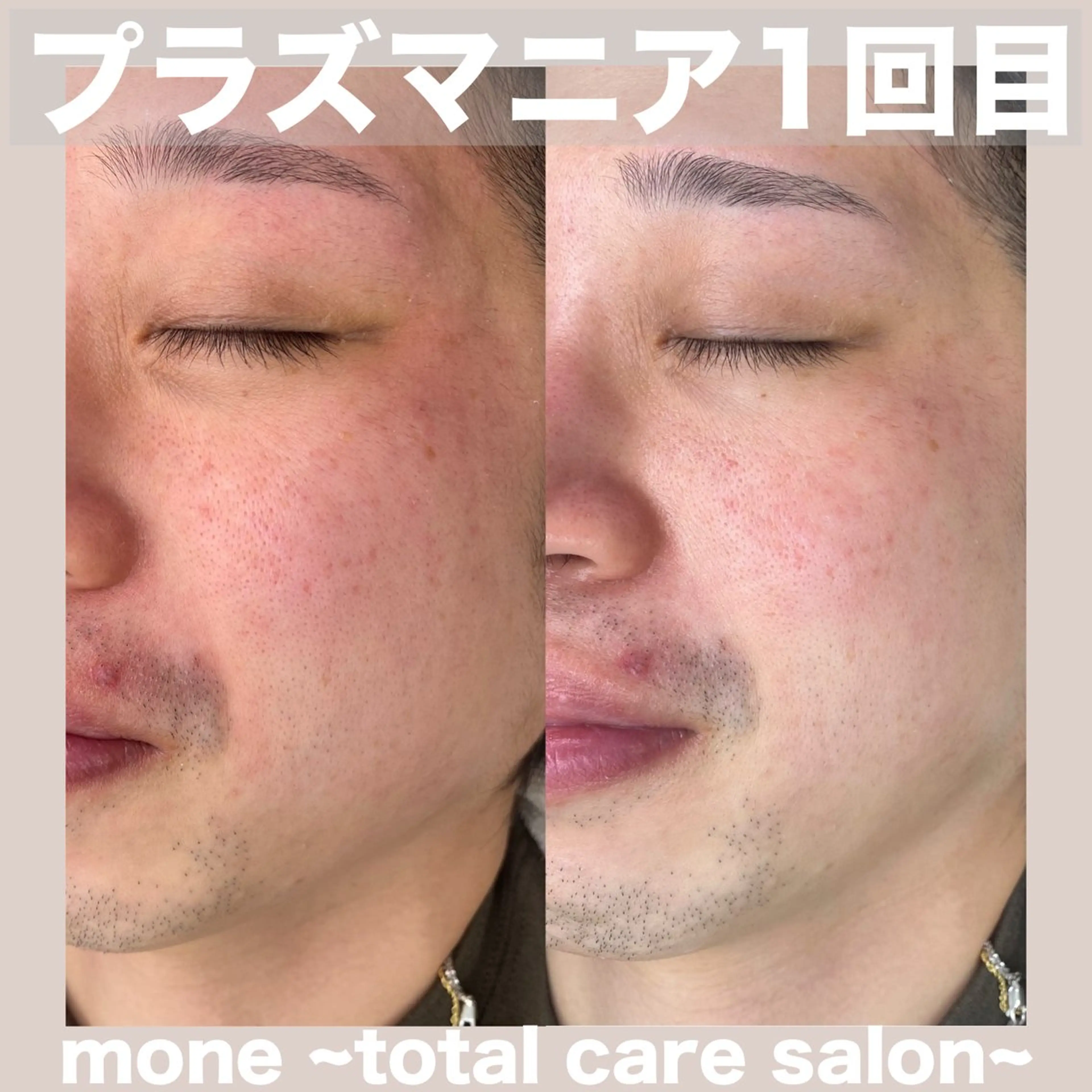 エステ mone~total care salon~所属・mone (モーネ)のマツエク・マツパデザイン