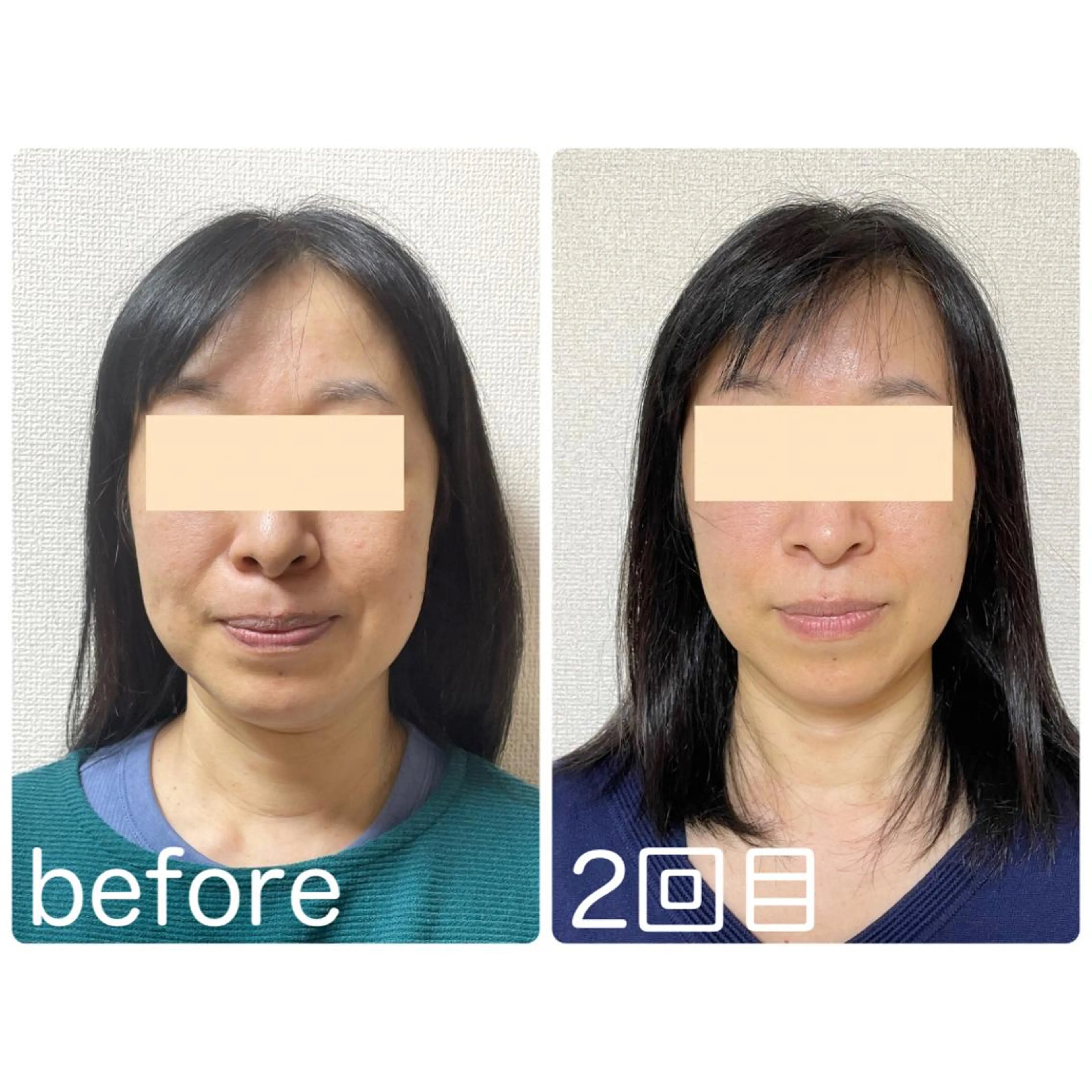 小顔矯正サロン　クレール所属・小顔矯正専門サロン クレールのエステ・リラクイメージ