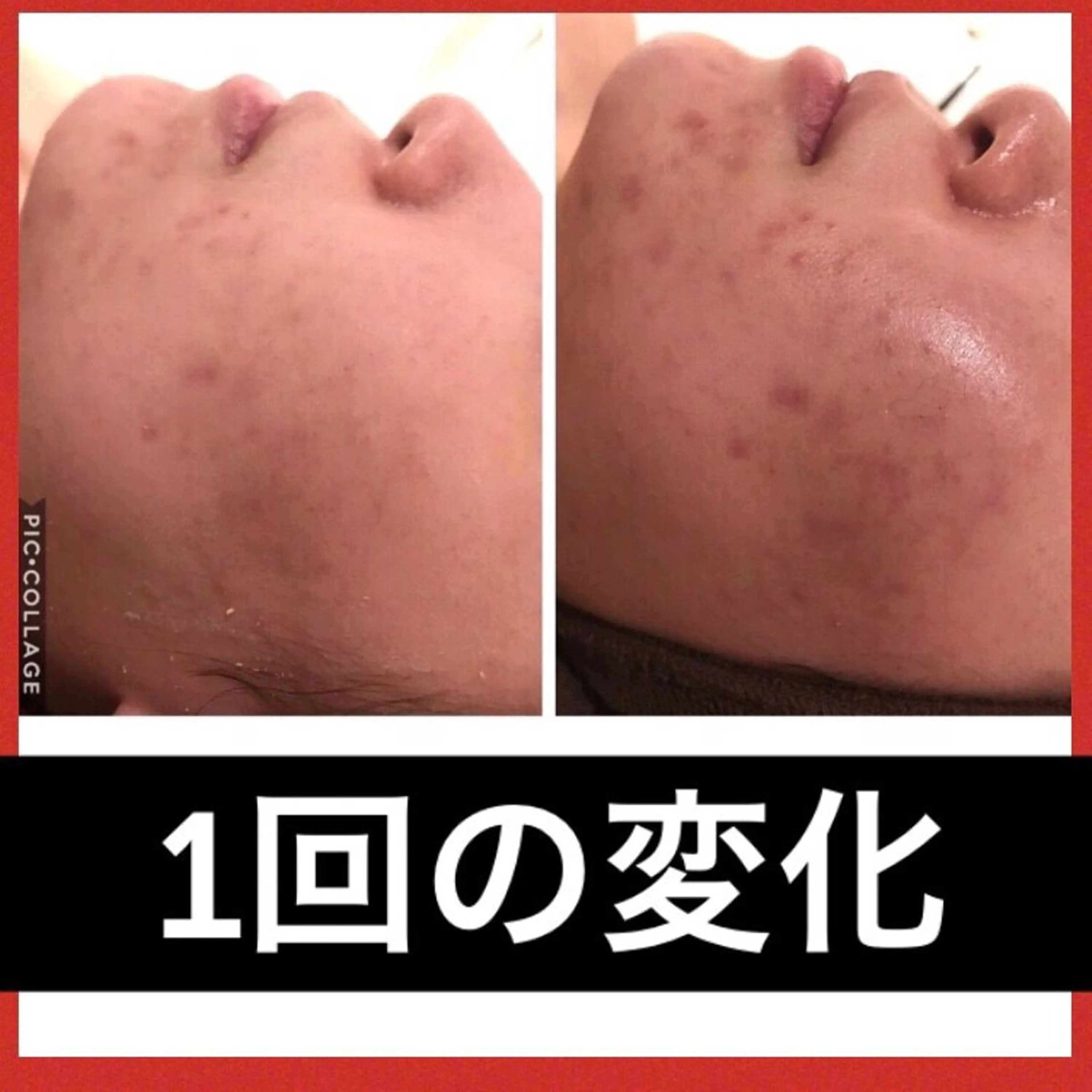 ミディアム パーマ ヘアアレンジ メンズ キッズ ネイル マツエク・マツパ ニキビ・肌質改善専門 ♡人生が変わるサロンのエステ・リラクイメージ