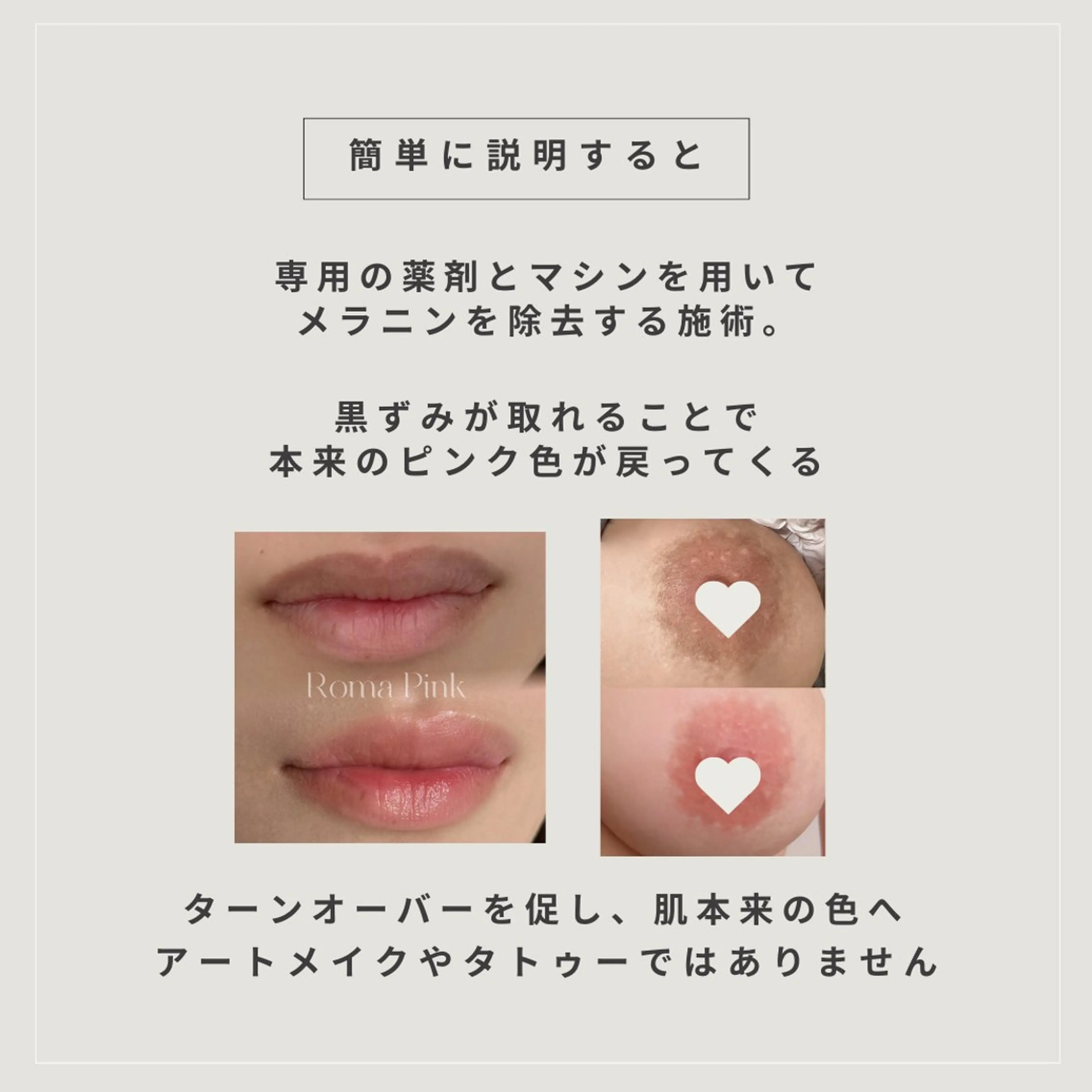 小顔/たるみ/黒ずみ除去専門サロン/SONA 大和西大寺店所属・【小顔専門看護師 サロンSONA】のエステ・リラクイメージ