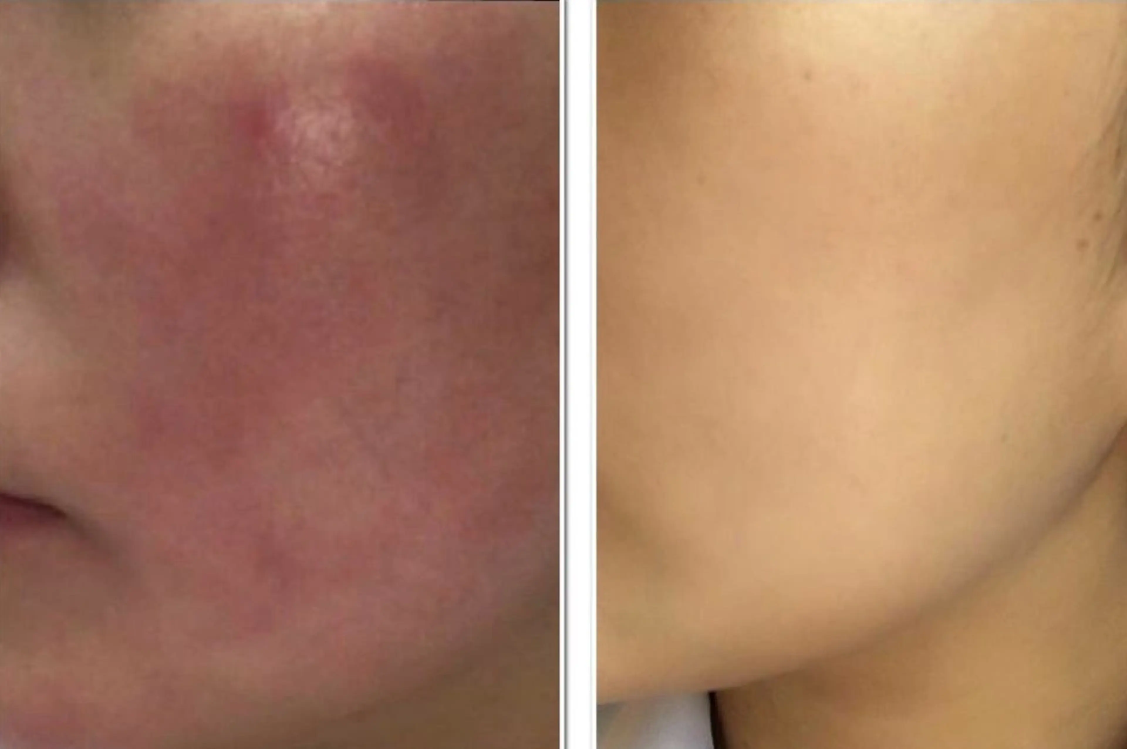 エステ ニキビ毛穴専門店Beautysalon Luana所属・小林 まいのエステ・リラクイメージ