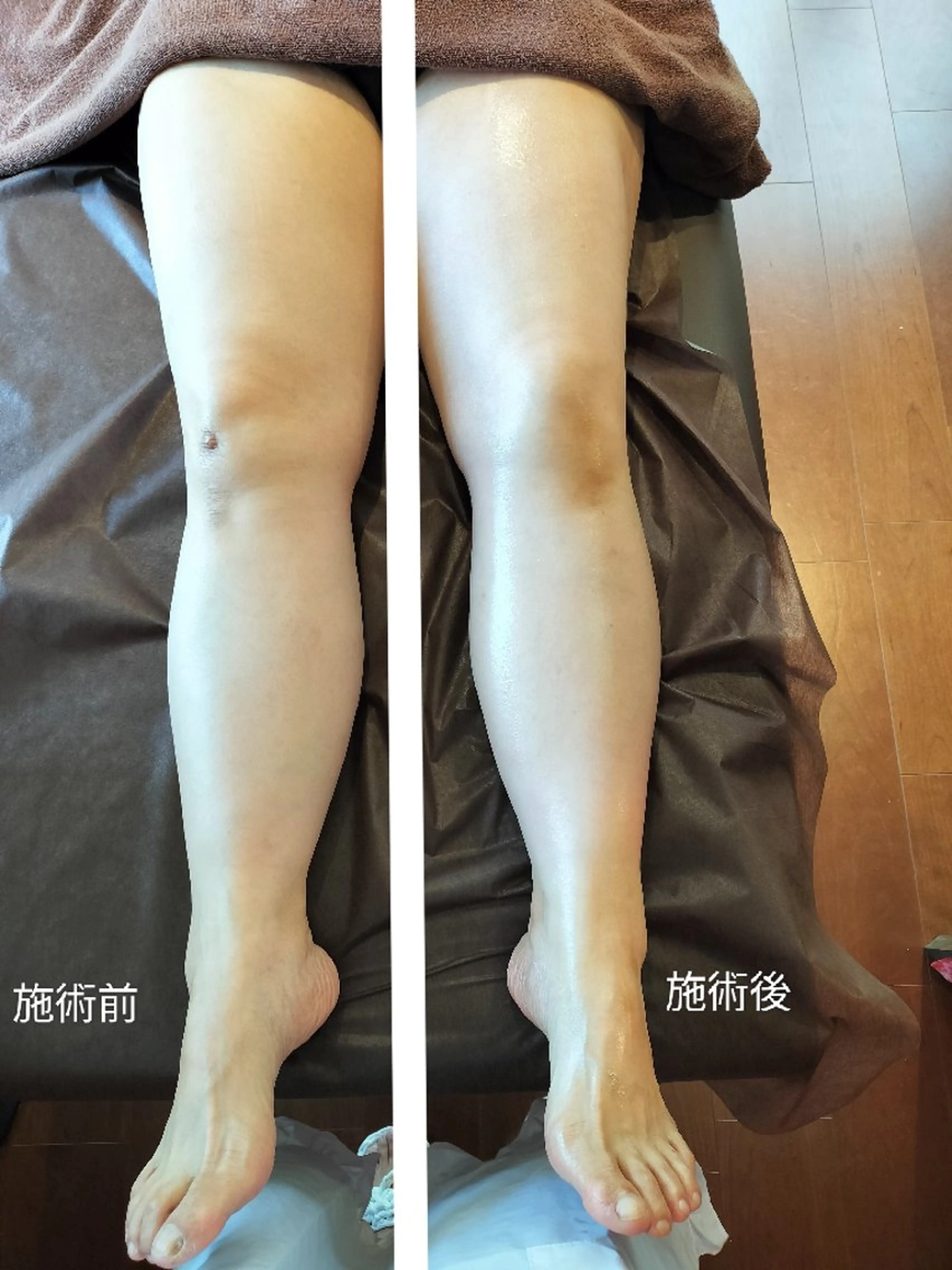 月下美人式リンパドレナージュ　60分の写真