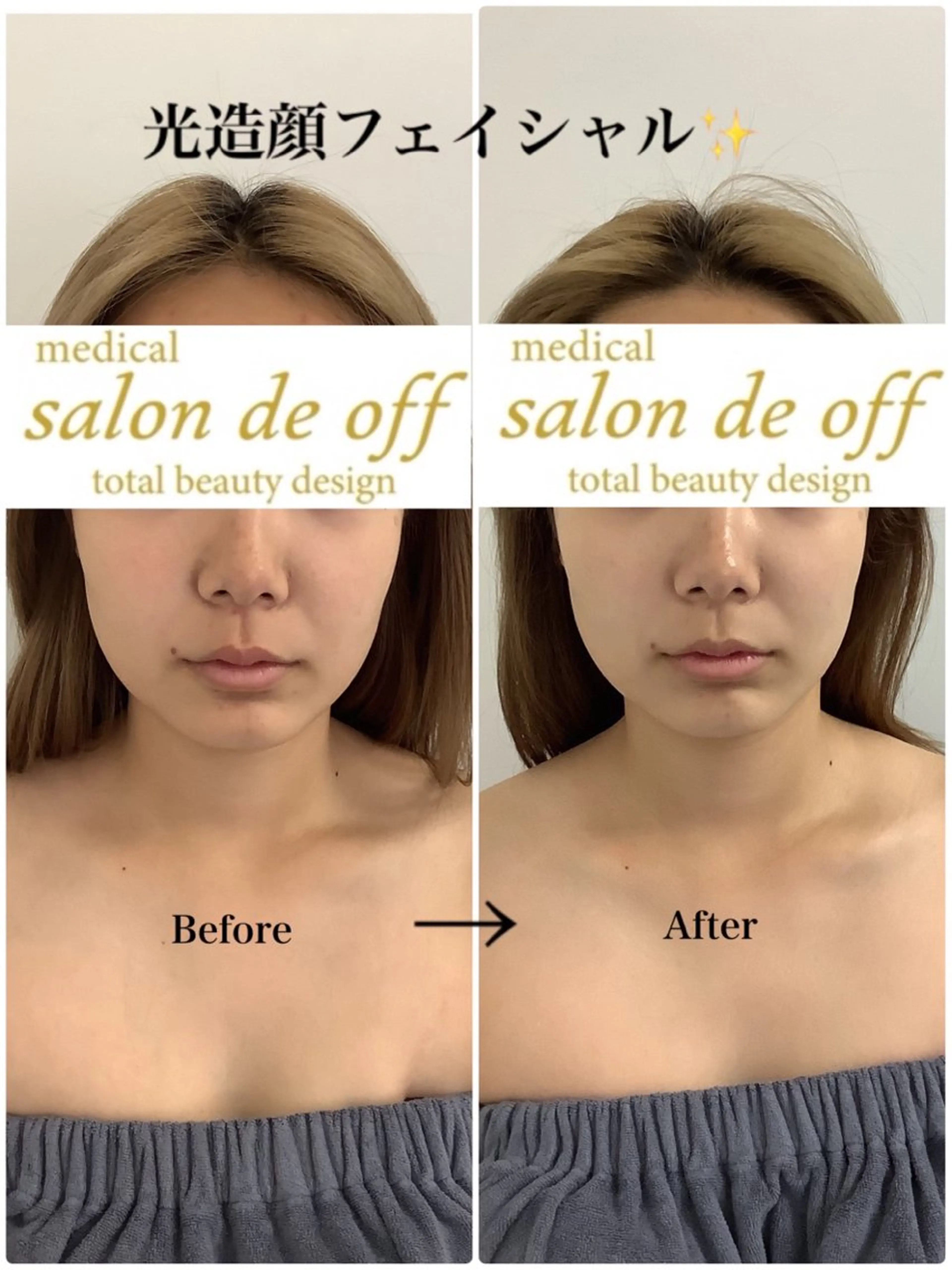 エステ リラク 🩵Tatsumi Kana🩵のエステ・リラクイメージ