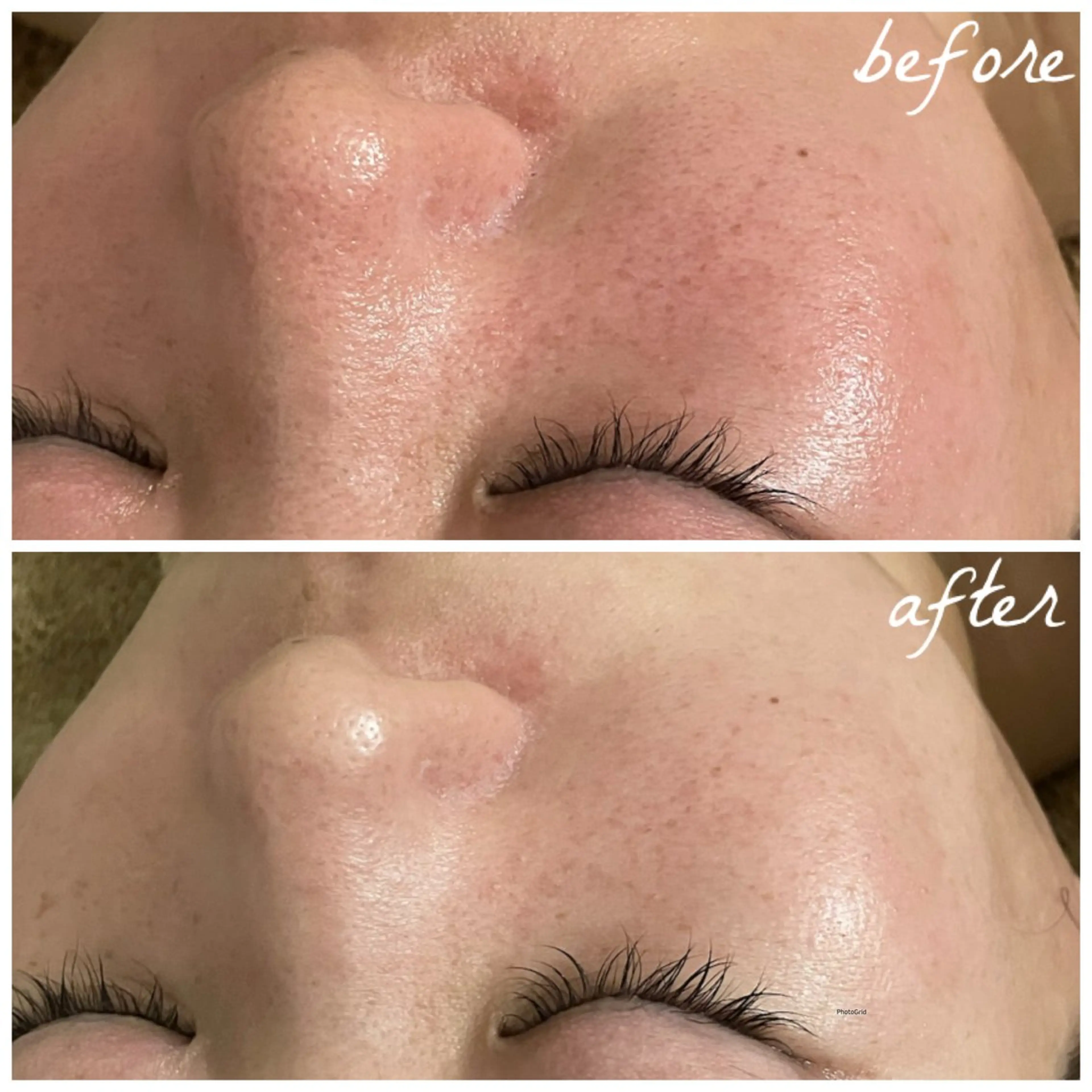 メンズ エステ メナード岐阜市茜部 杉浦のエステ・リラクイメージ