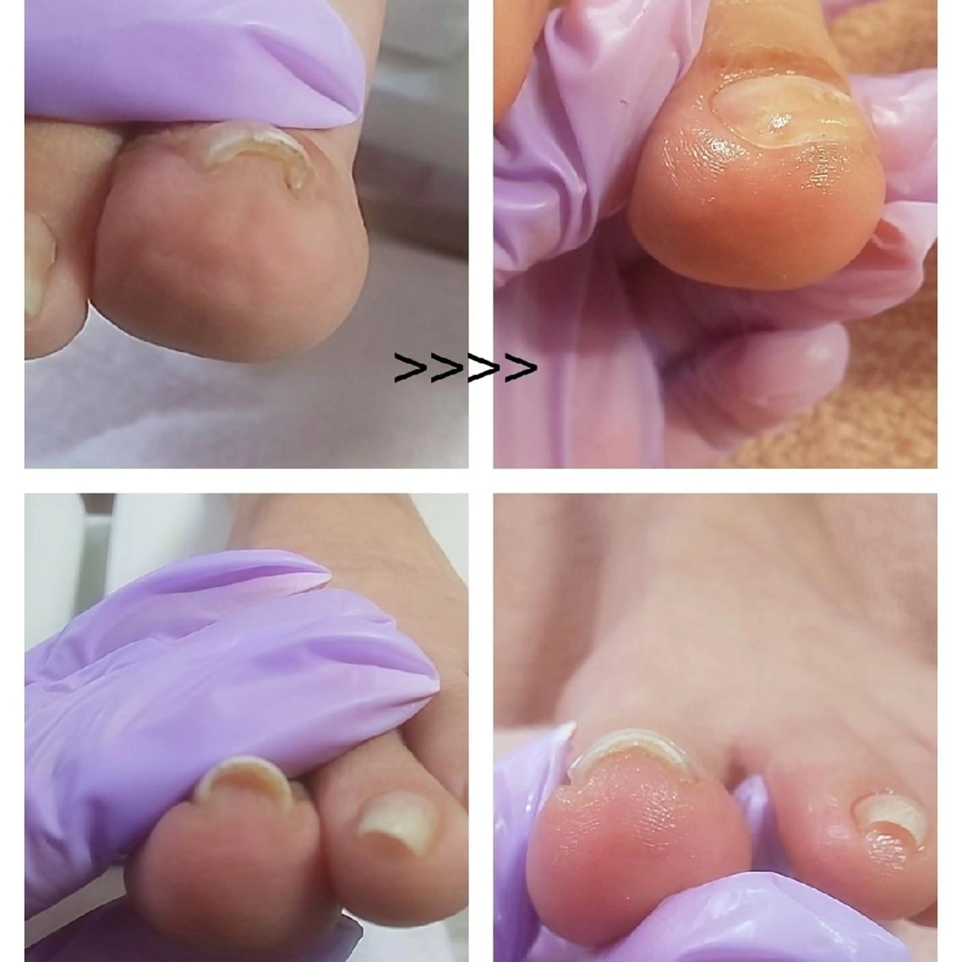 ネイル ネイルサロン AlmondEyeのネイルデザイン