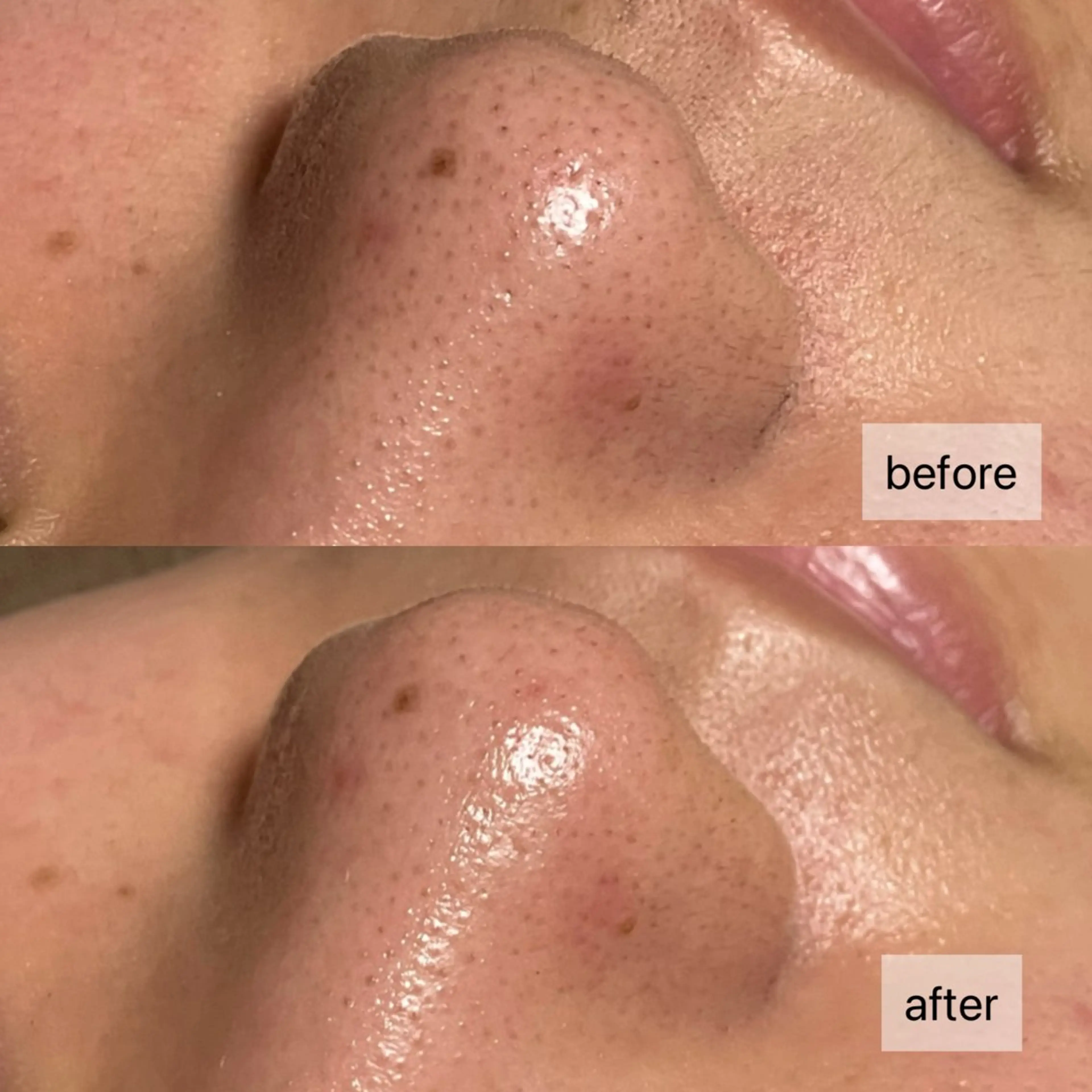 エステ HINANO矢場町店【ヒナノ】所属・脱毛/肌改善🌿 HINANO 村田のエステ・リラクイメージ