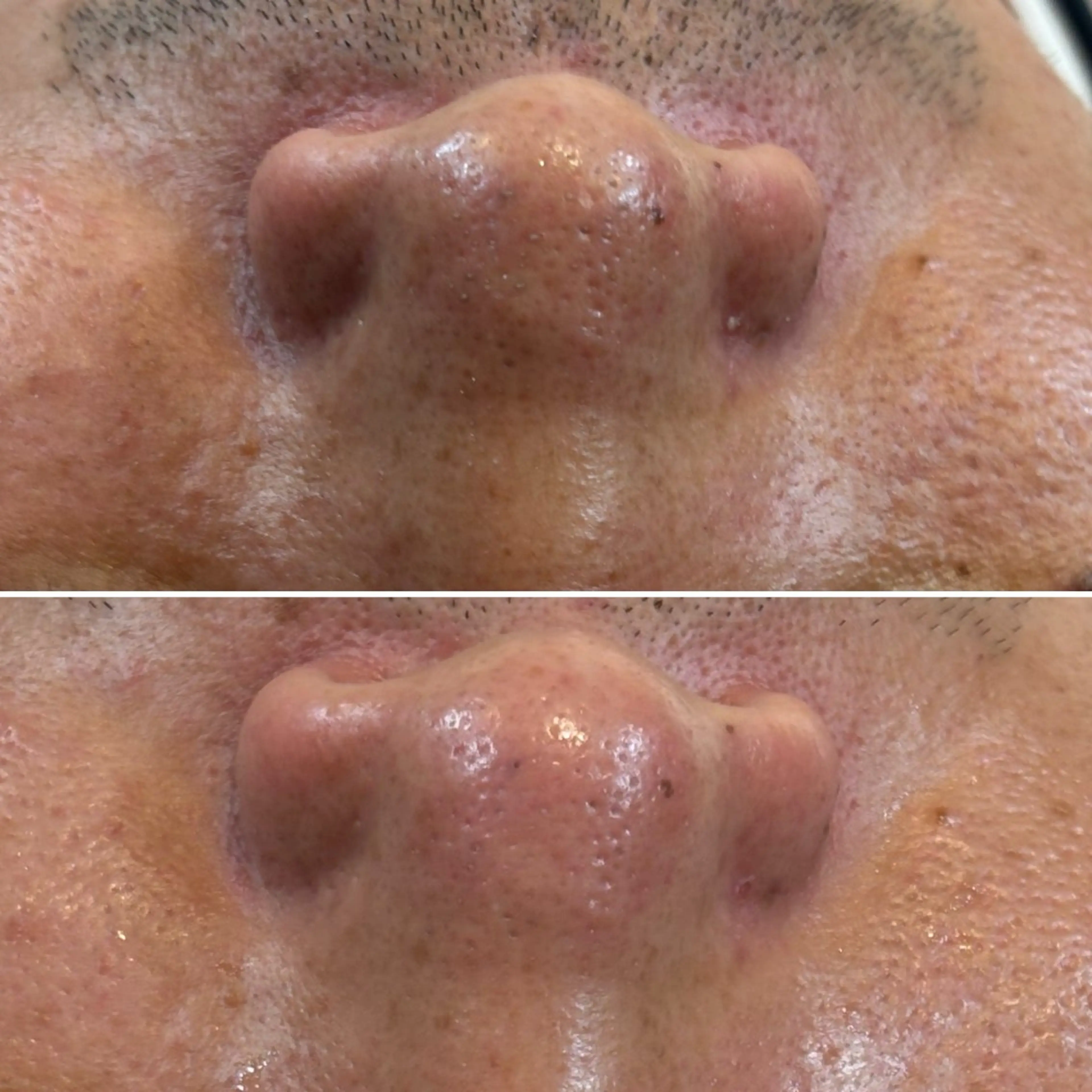 メンズ エステ By color  EYE&NAIL所属・BY  COLOR eyedesinのマツエク・マツパデザイン