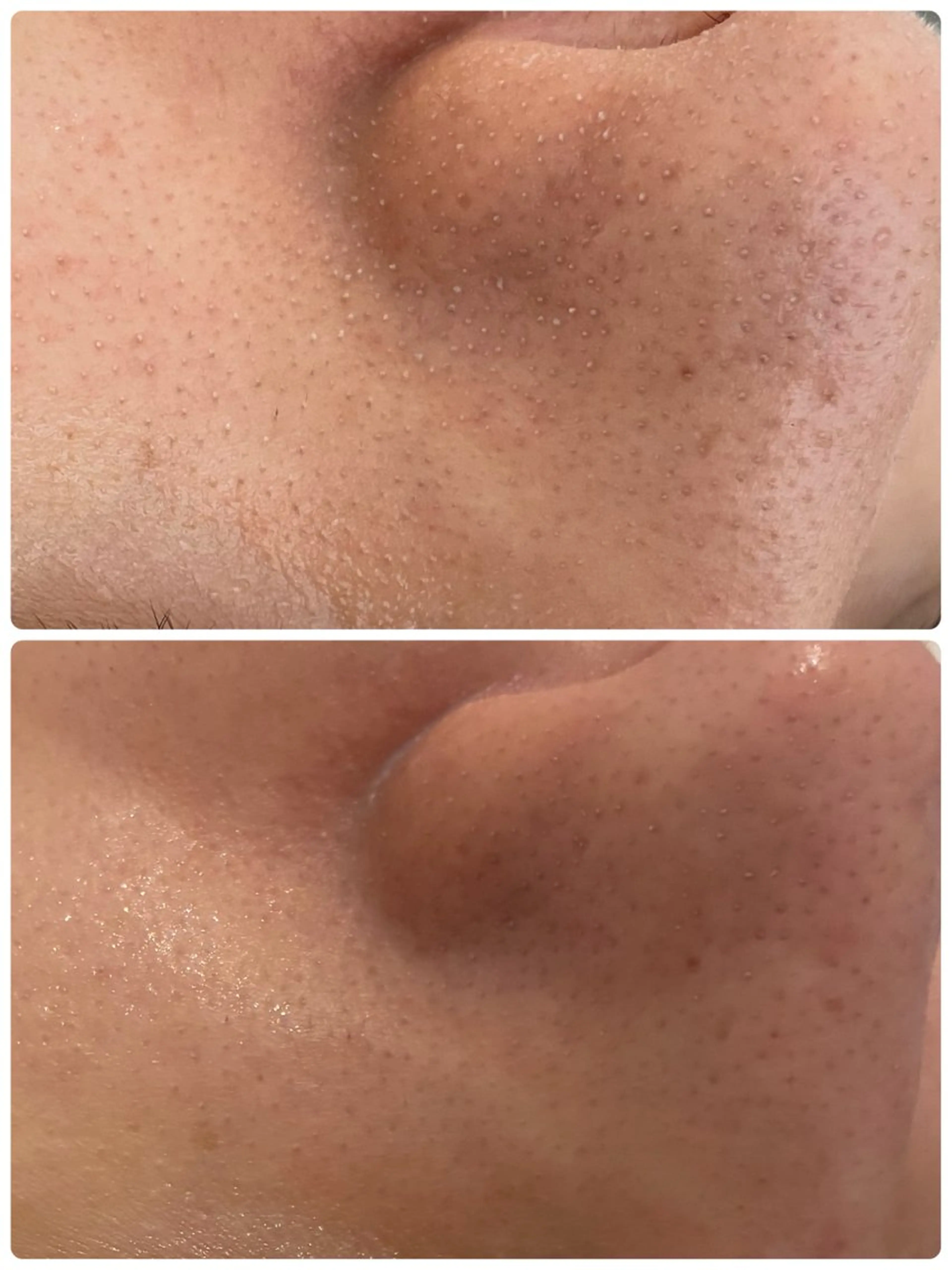 ご新規様限定♡うるおいフェイシャルトリートメントの写真