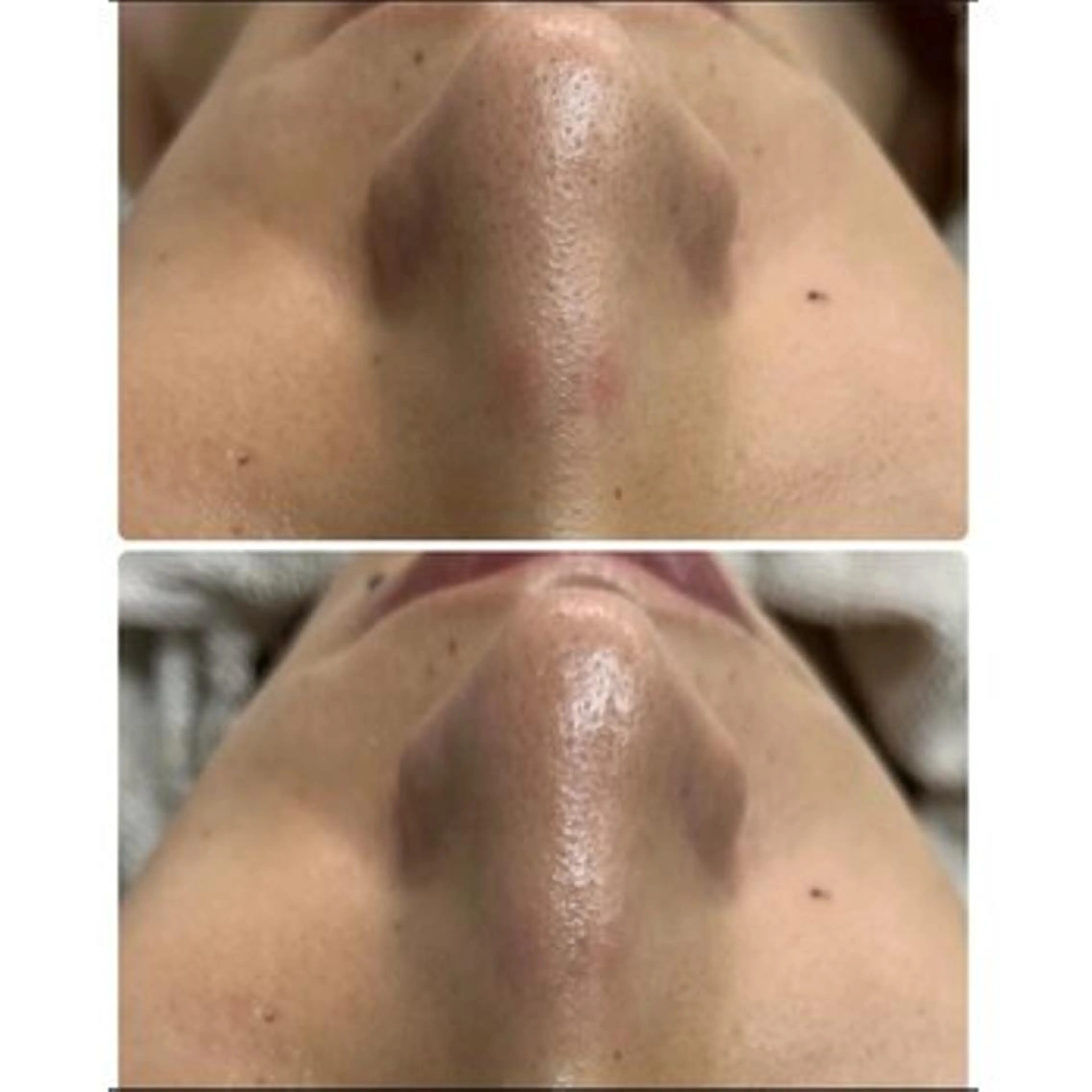 トラブル肌専門店 プレイス天王寺店のエステ・リラクイメージ