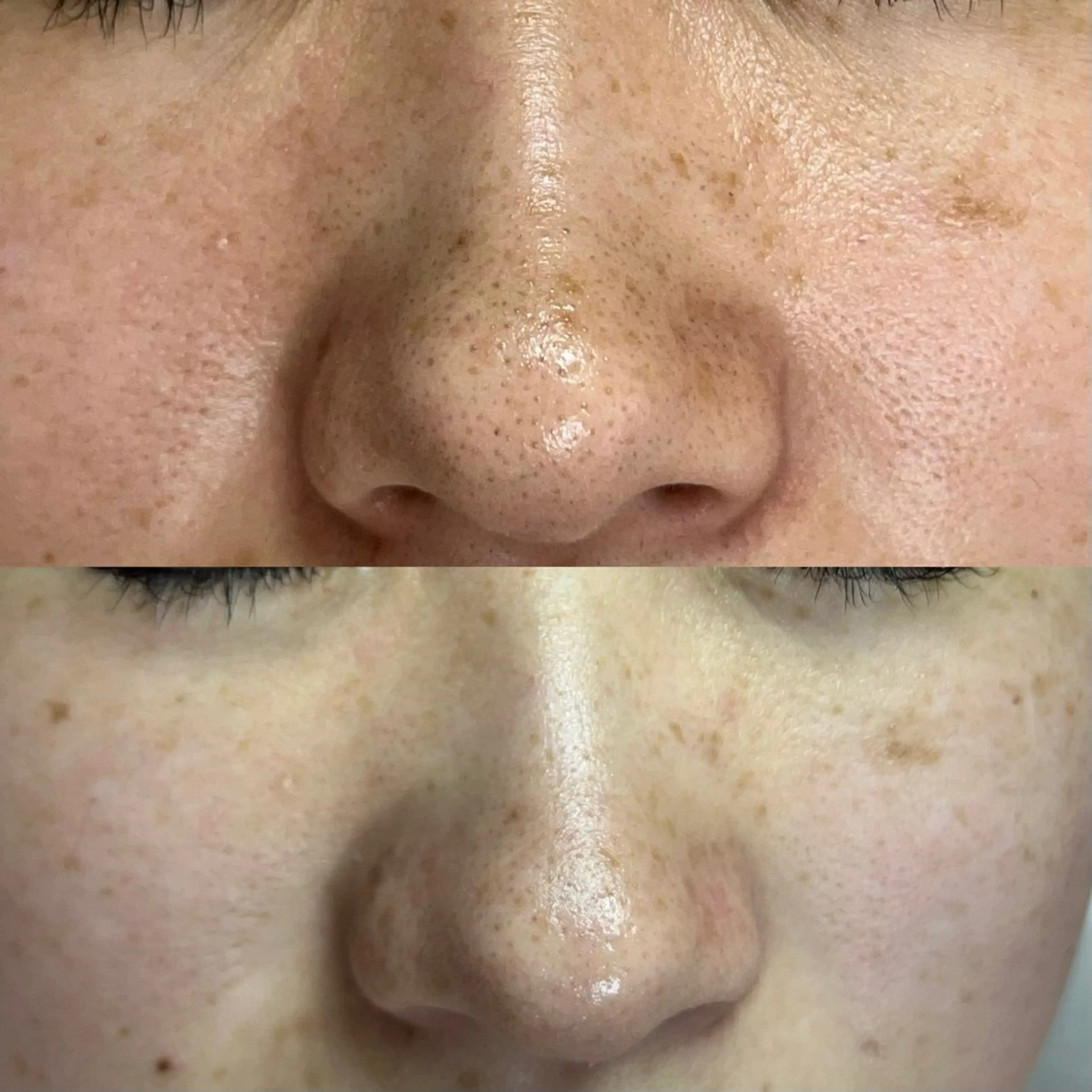 毛穴ケア・ヘッドスパサロンSHINY(シャイニー)所属・毛穴ケア・ヘッドスパ サロンSHINYのエステ・リラクイメージ