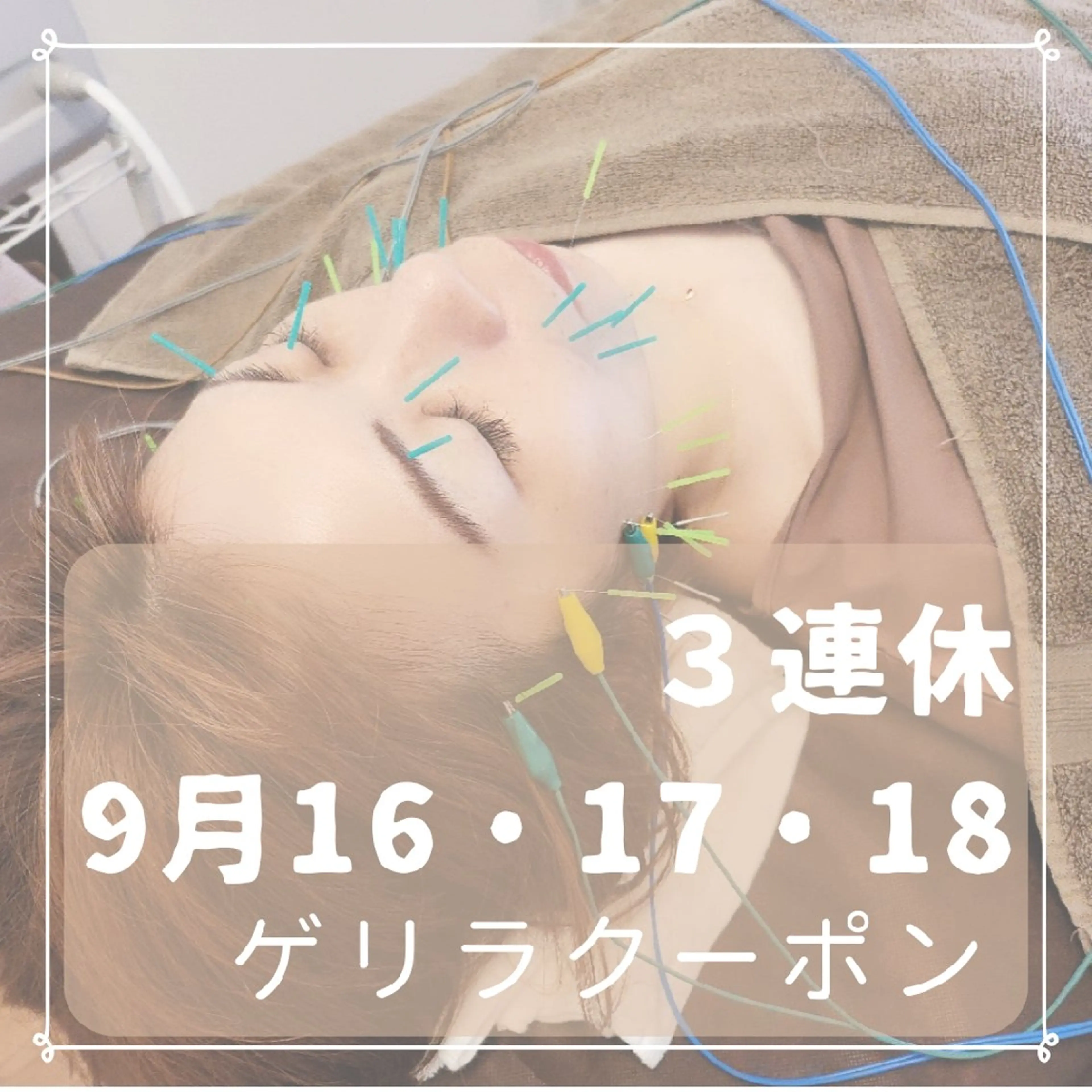 即効⚡小顔美容鍼🪡 むくみたるみ脂肪解消のエステ・リラクイメージ