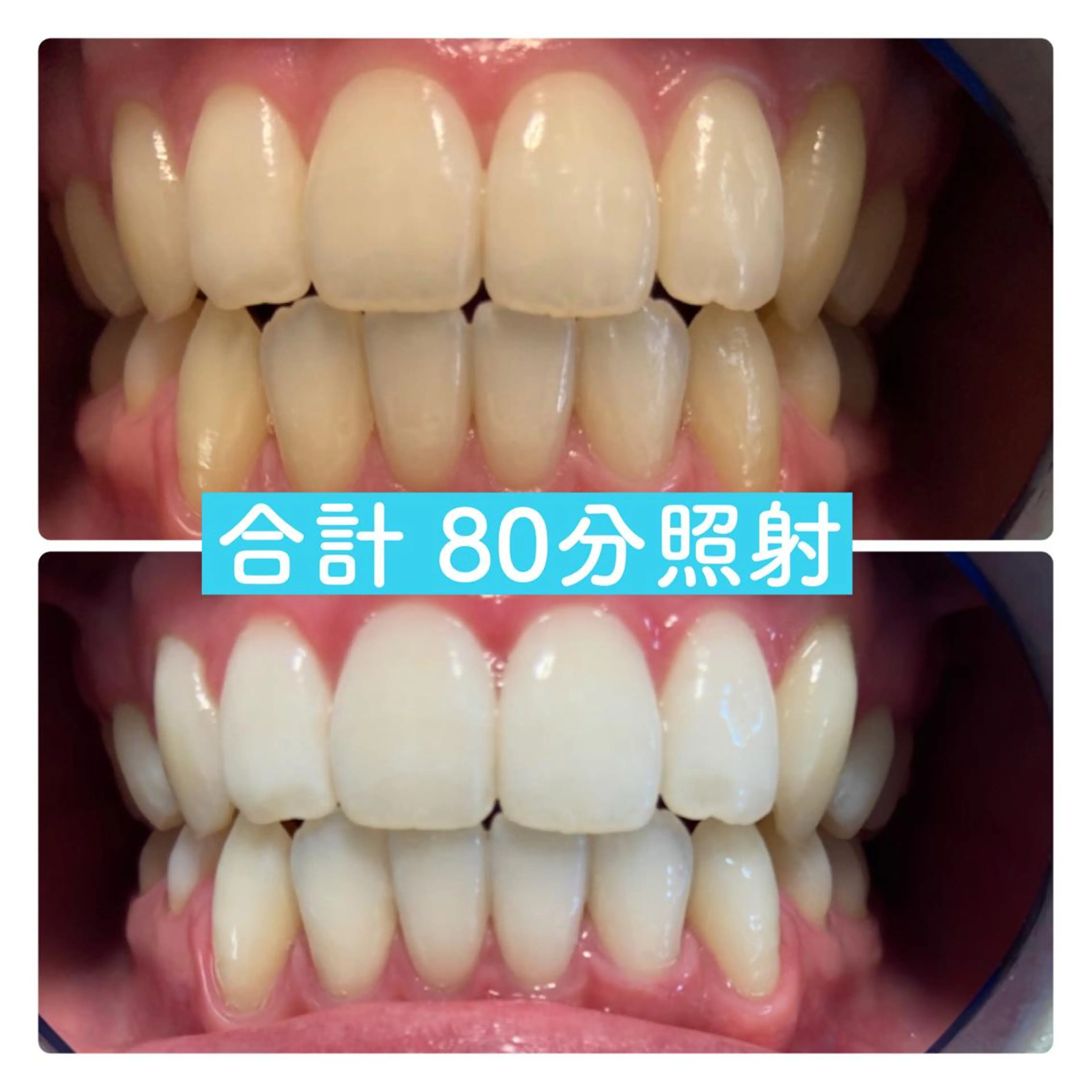 その他 PLATINUM Beauty 横浜店所属・ホワイトニングルーム 横浜店のその他イメージ