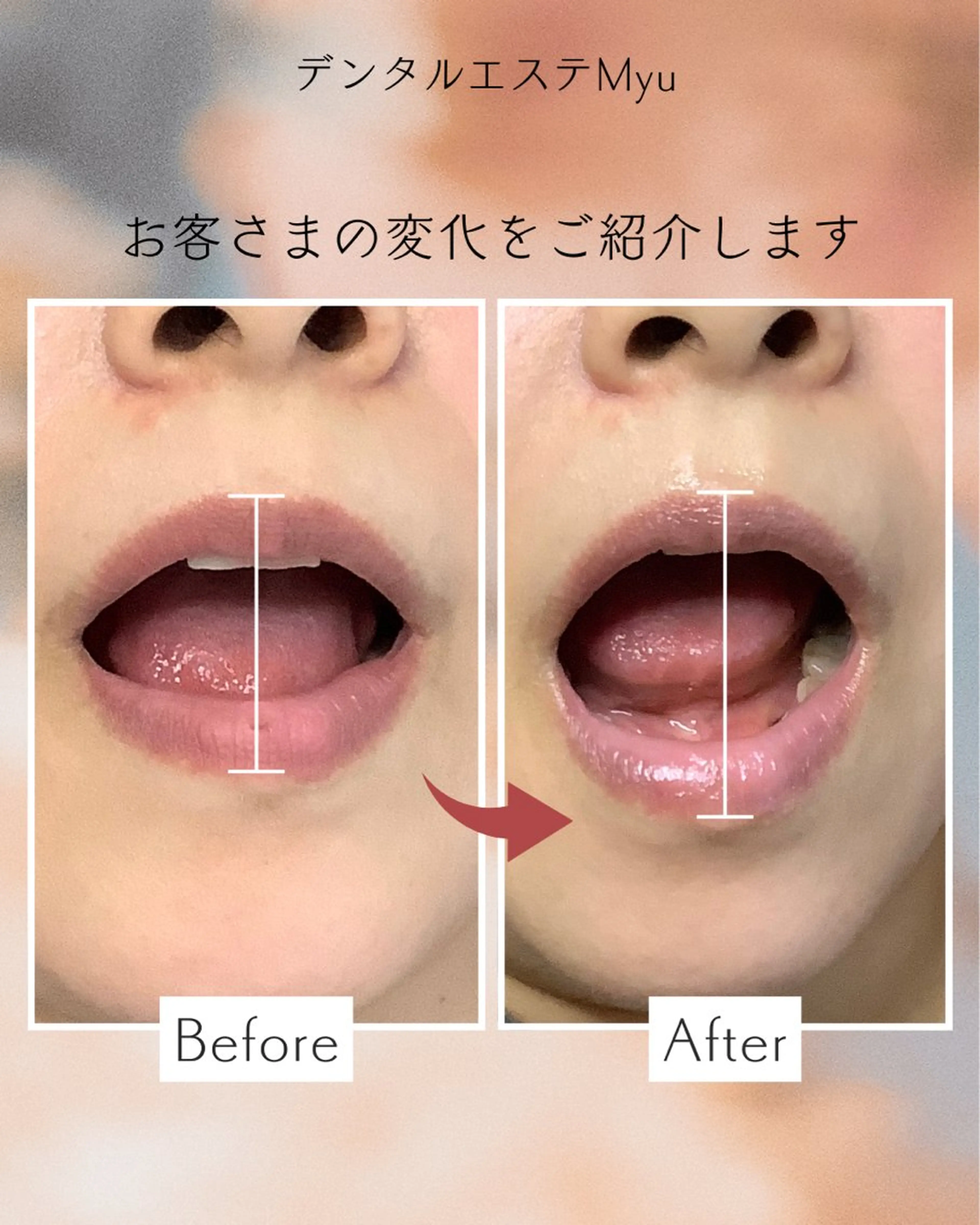 Myu所属・Suzuki Yumiのエステ・リラクイメージ