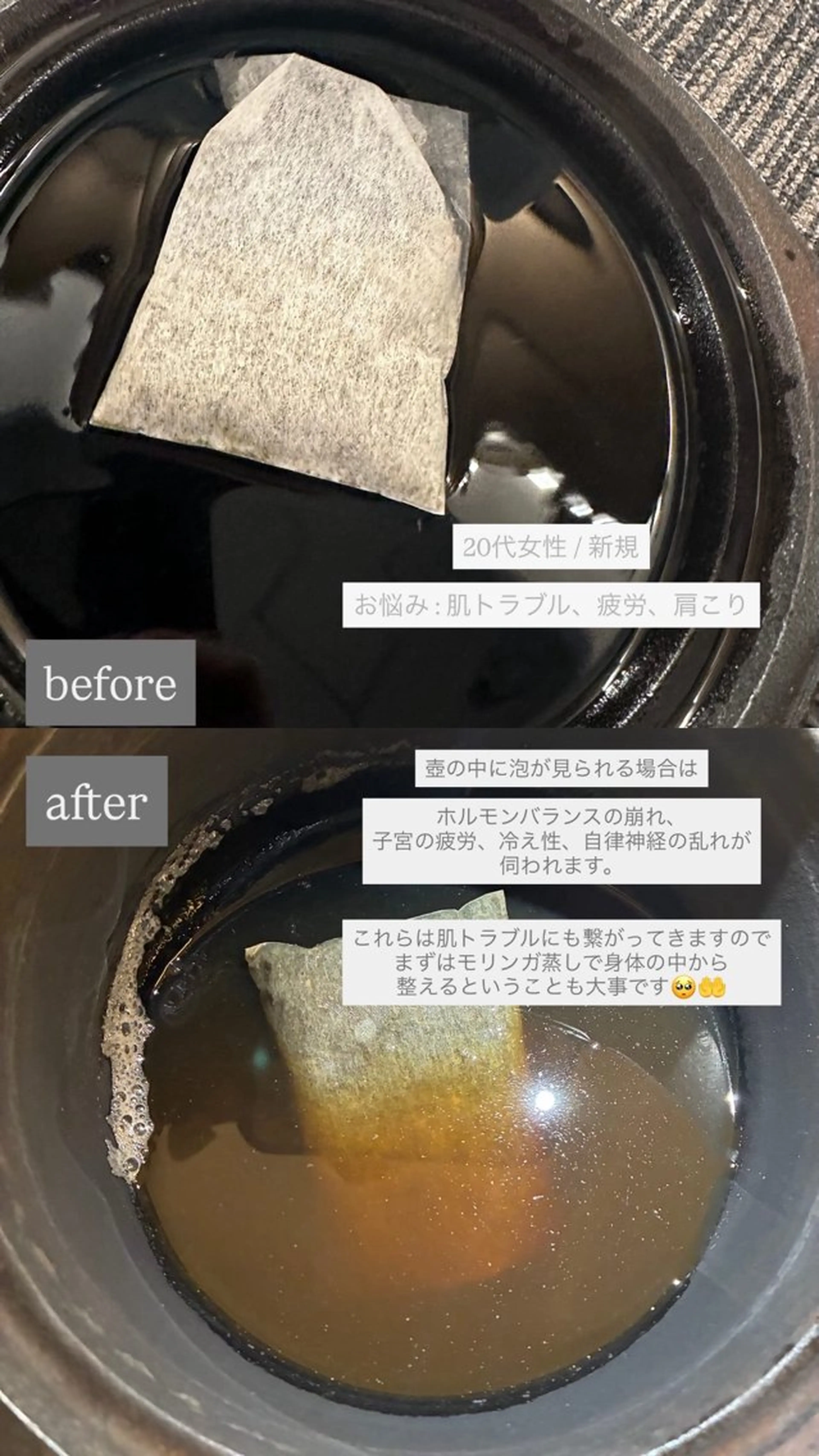 chouchou【シュシュ】所属・トータルボディケア chouchouのエステ・リラクイメージ