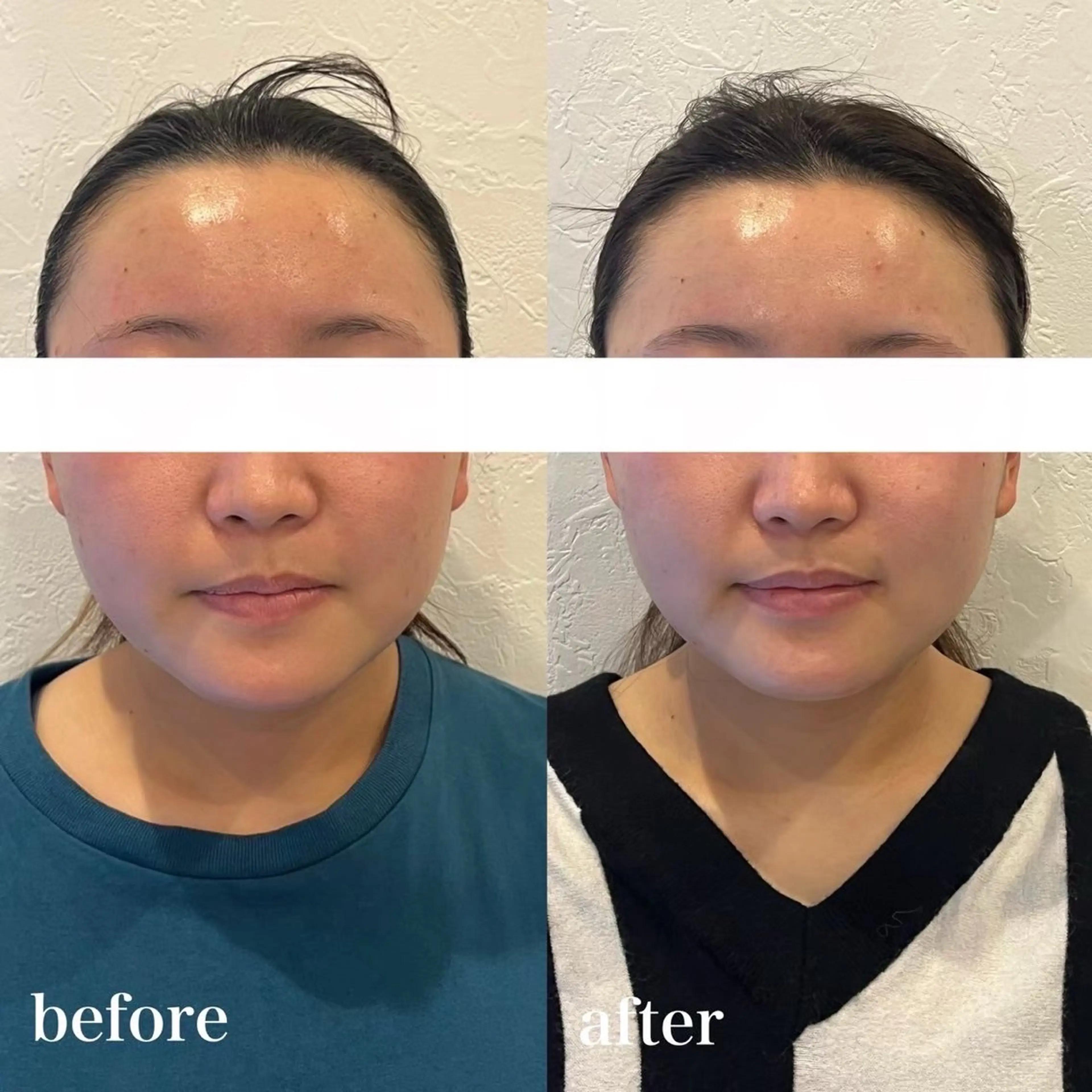 【平日限定🧸】小顔コルギ＋選べるオプション70分￥19500→￥5000の写真