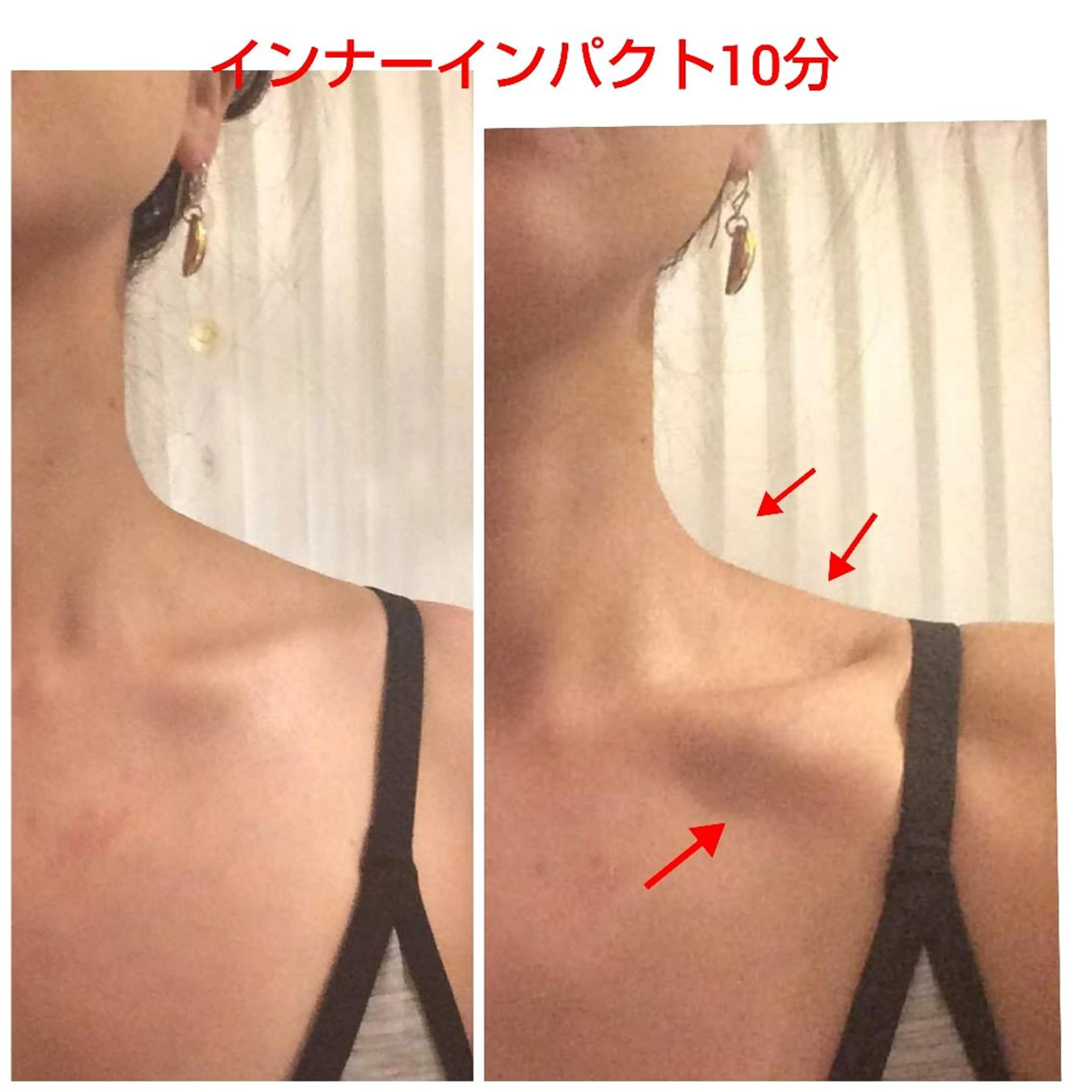 【ニキビ/肌管理】 salon varyのエステ・リラクイメージ