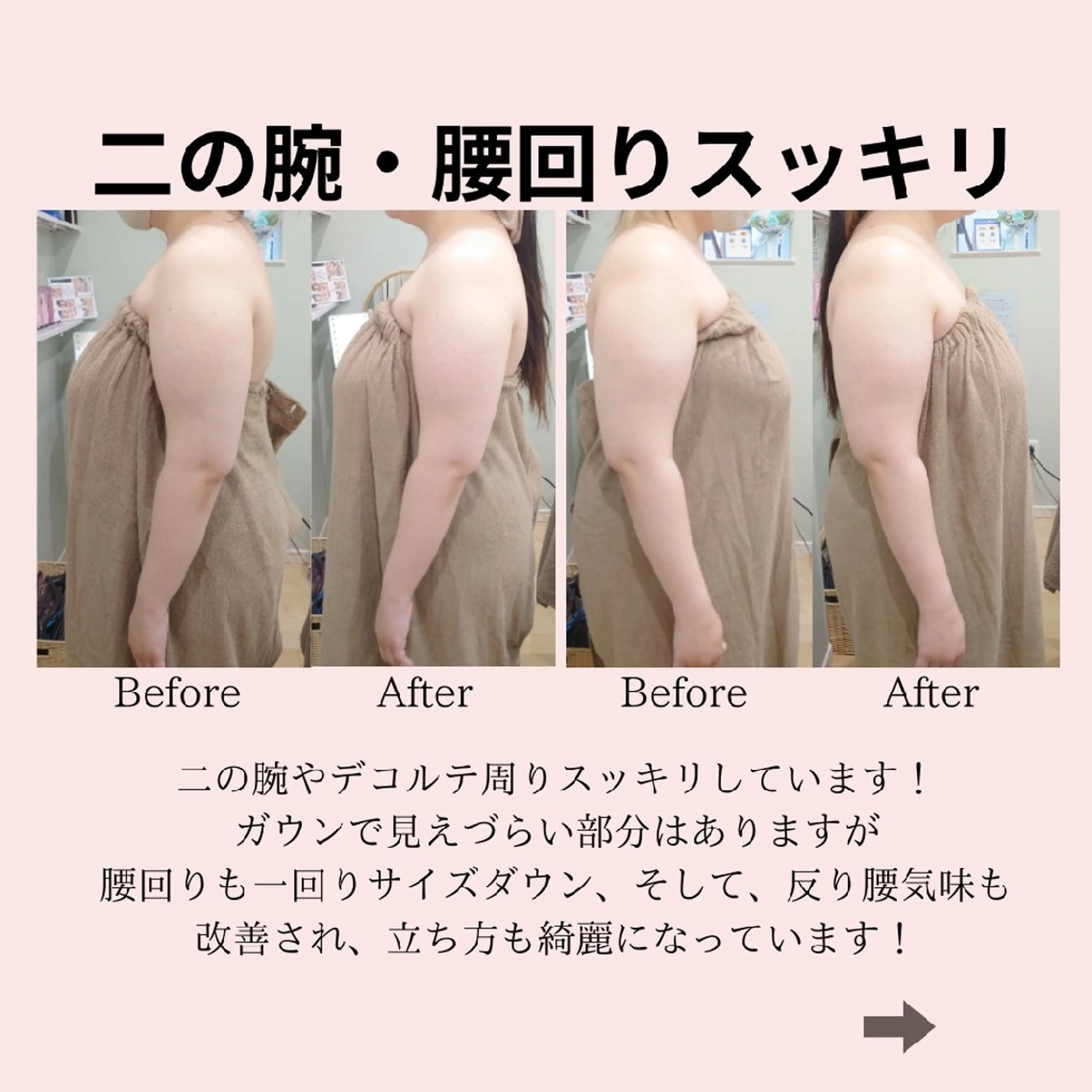 エステ PRETTIEST SHINE所属・山田 浩子のエステ・リラクイメージ