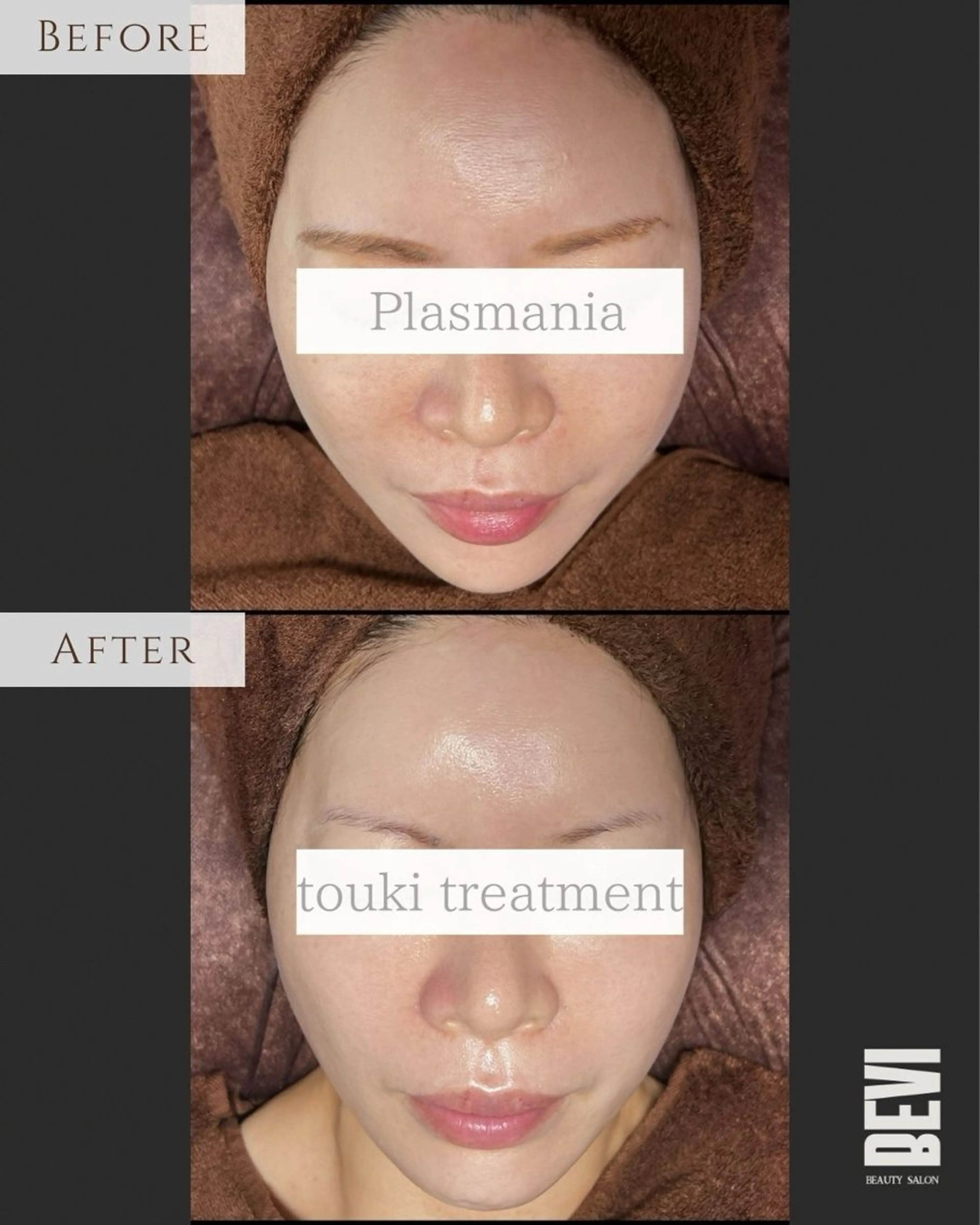 エステ Bevi salonのその他イメージ