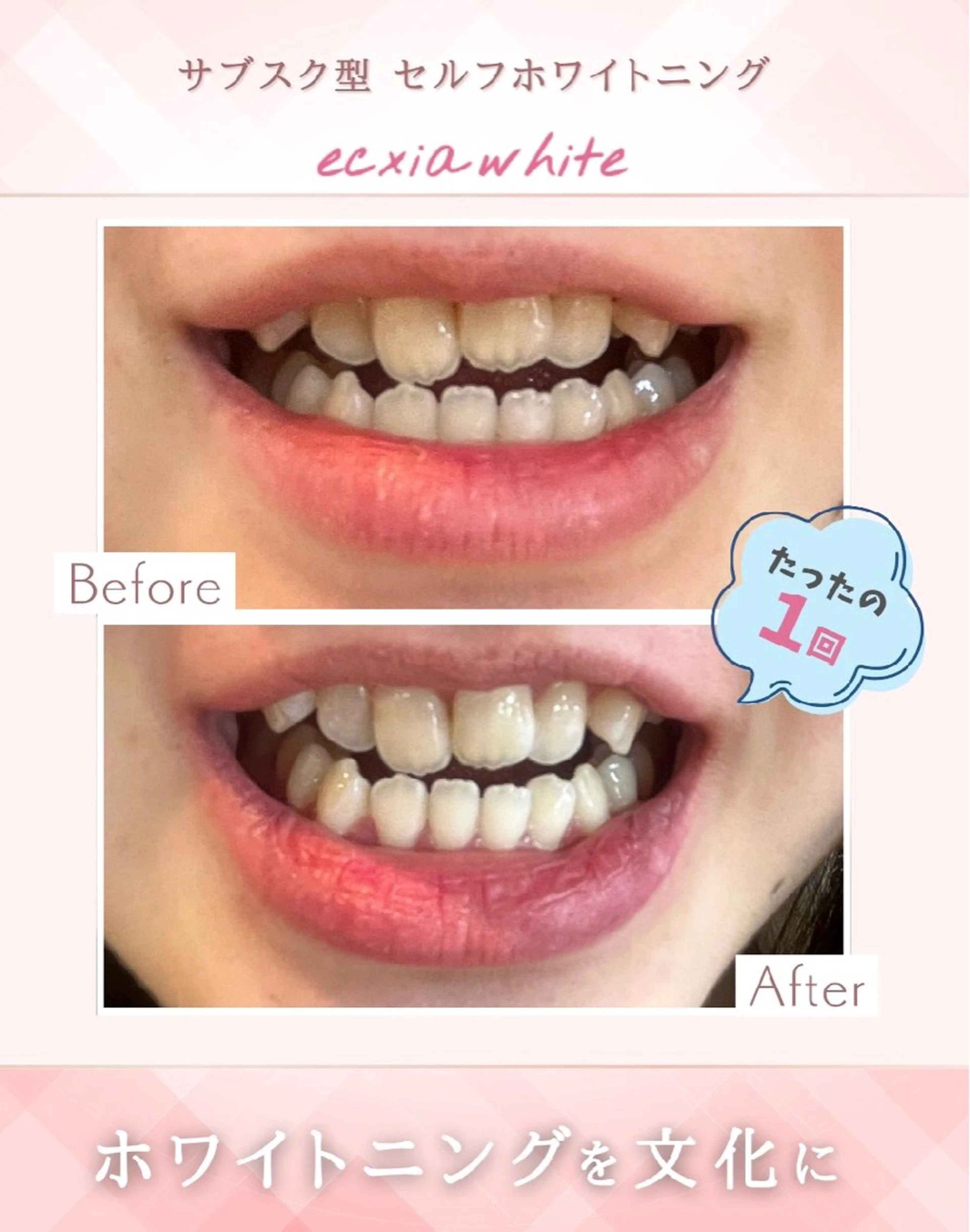 その他 エクシアホワイト 立川南口のエステ・リラクイメージ