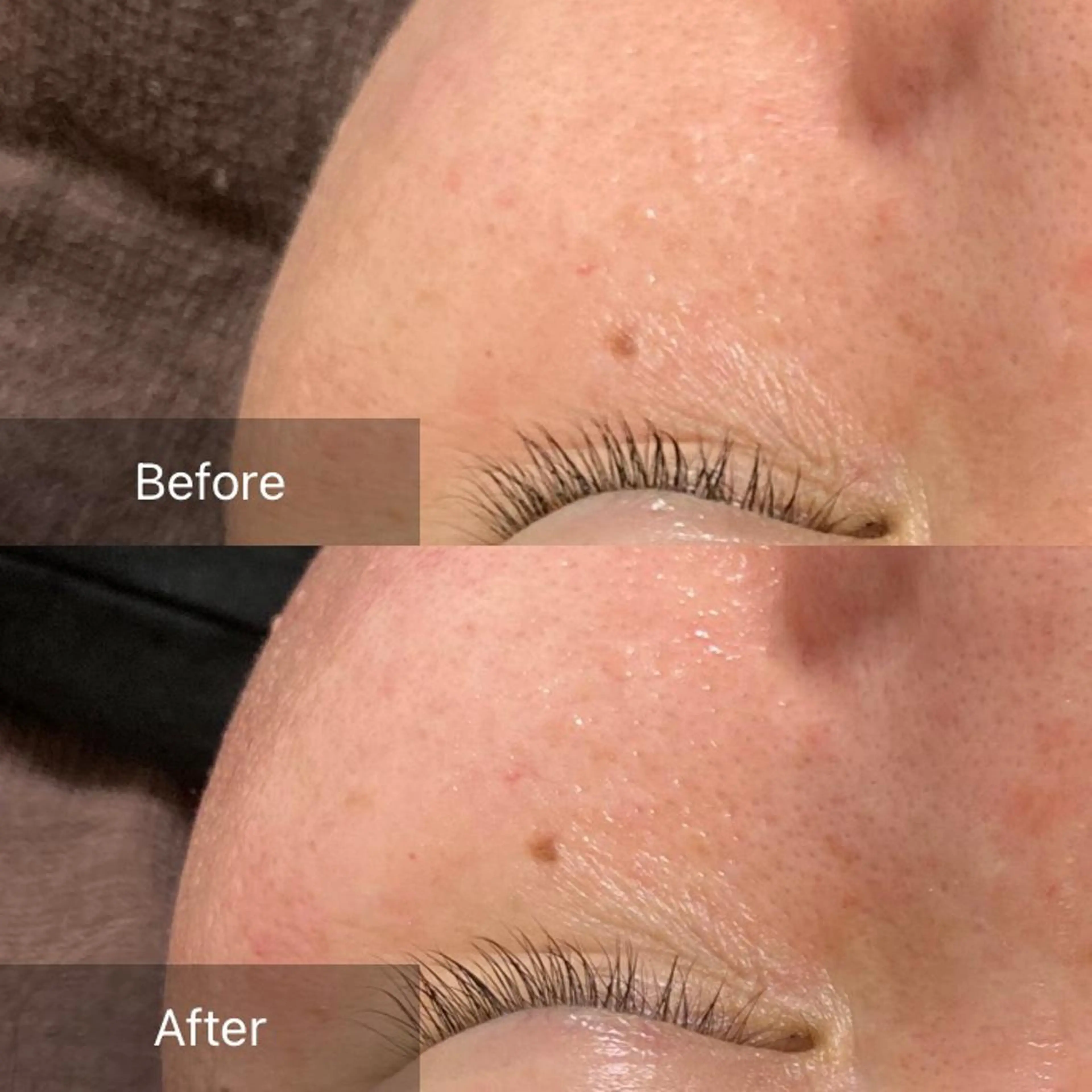 脱毛 産毛専門店 Bittoのエステ・リラクイメージ