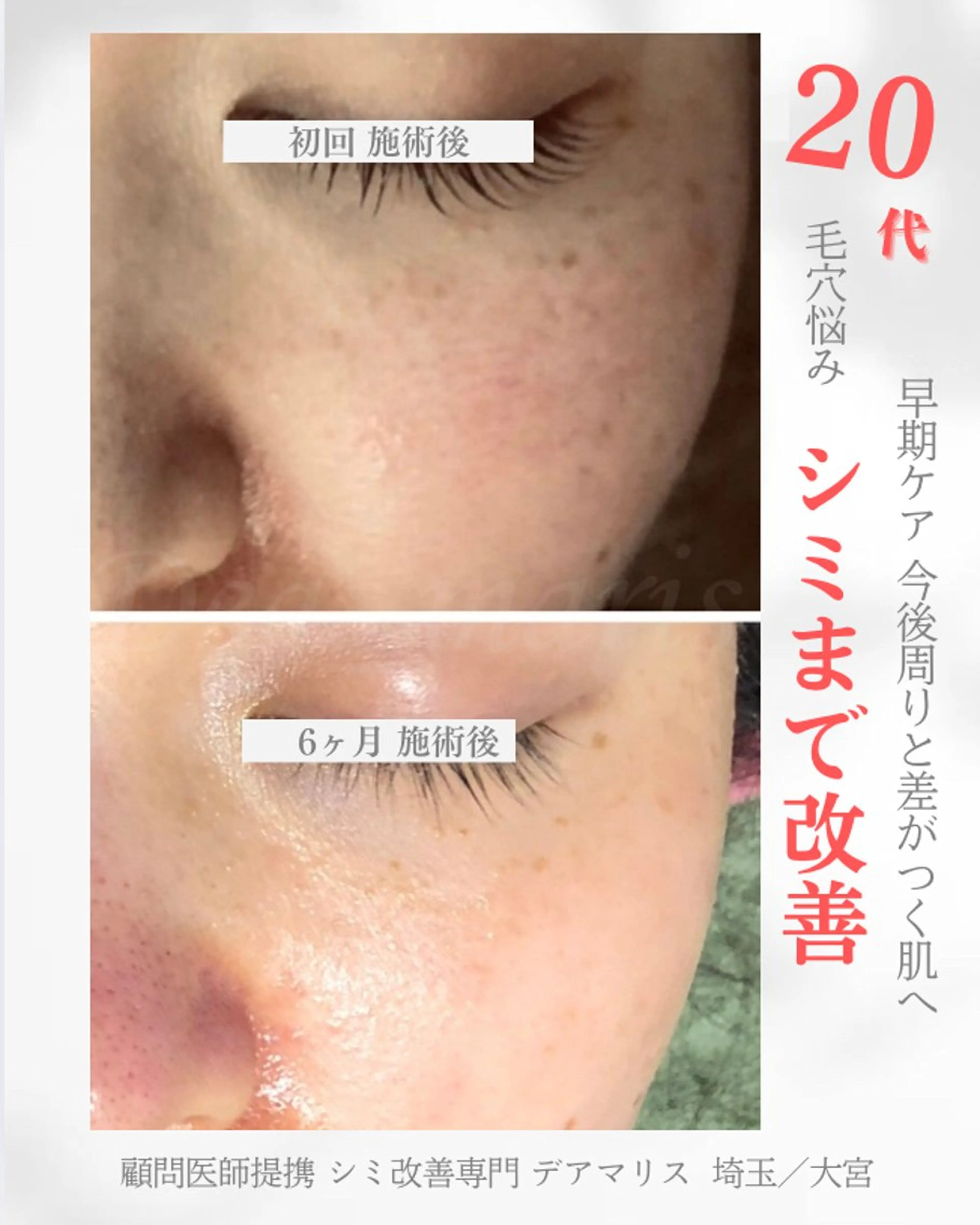 エステ リラク private salon Dea_maris シュガーリング&パーソナルボディケア所属・シミ改善・韓国肌管理 ボディメイク痩身のその他イメージ