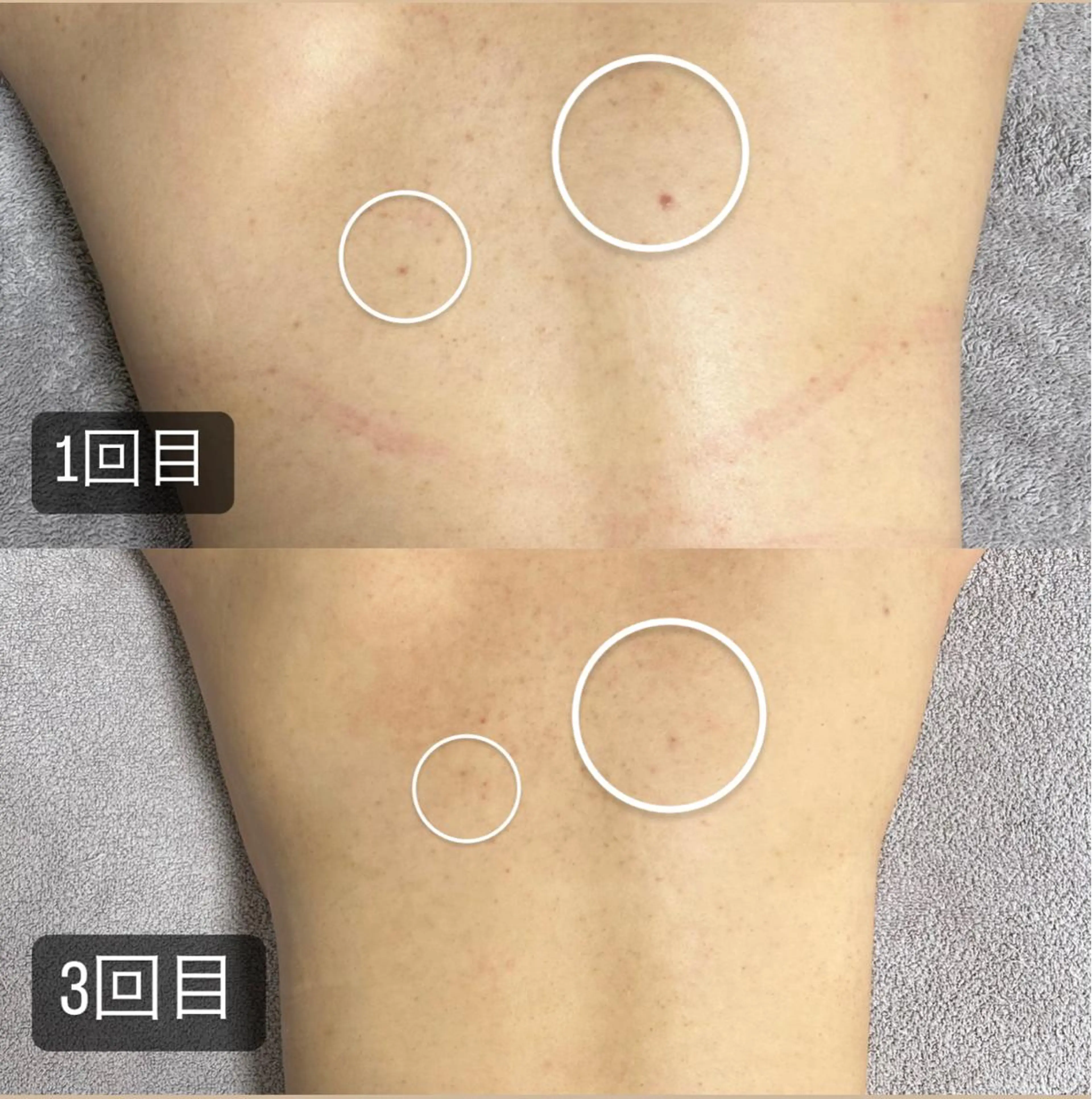 エステ 217whitening  room所属・217 ホワイトニングルームのエステ・リラクイメージ